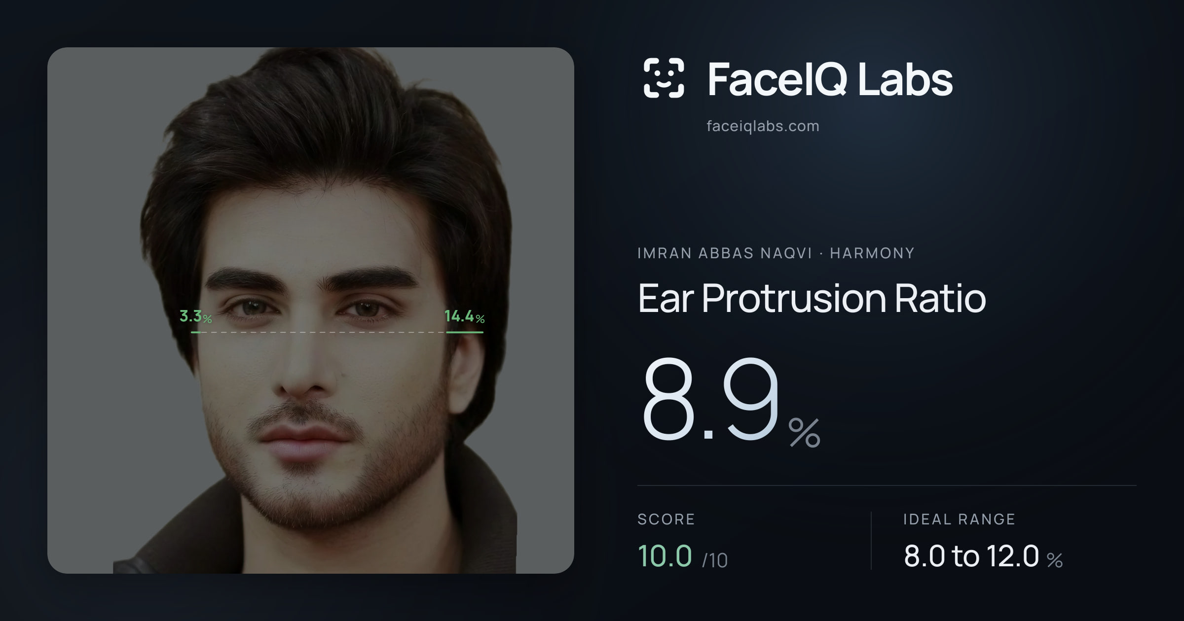 Imran Abbas Naqvi Ear Protrusion Ratio: 8.9%, drawn on the photo