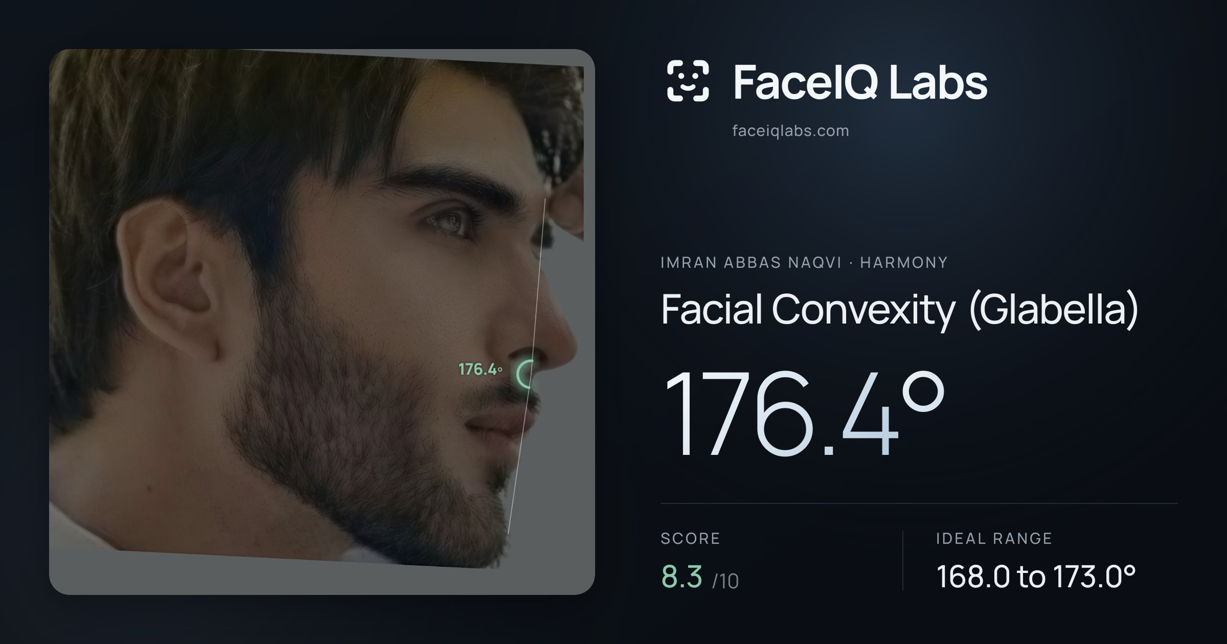 Imran Abbas Naqvi Facial Convexity (Glabella): 176.4°, drawn on the photo