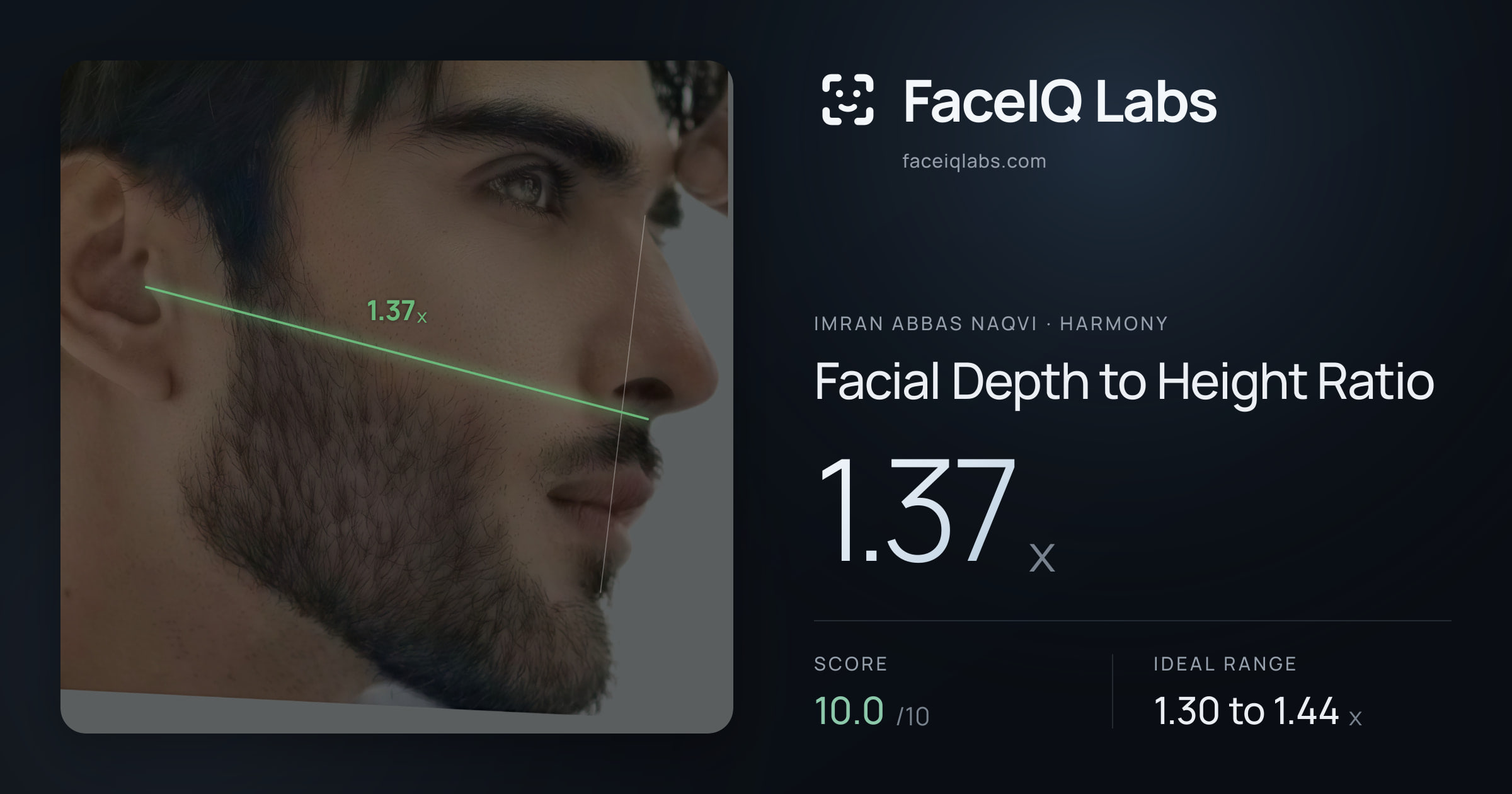 Imran Abbas Naqvi Facial Depth to Height Ratio: 1.37x, drawn on the photo