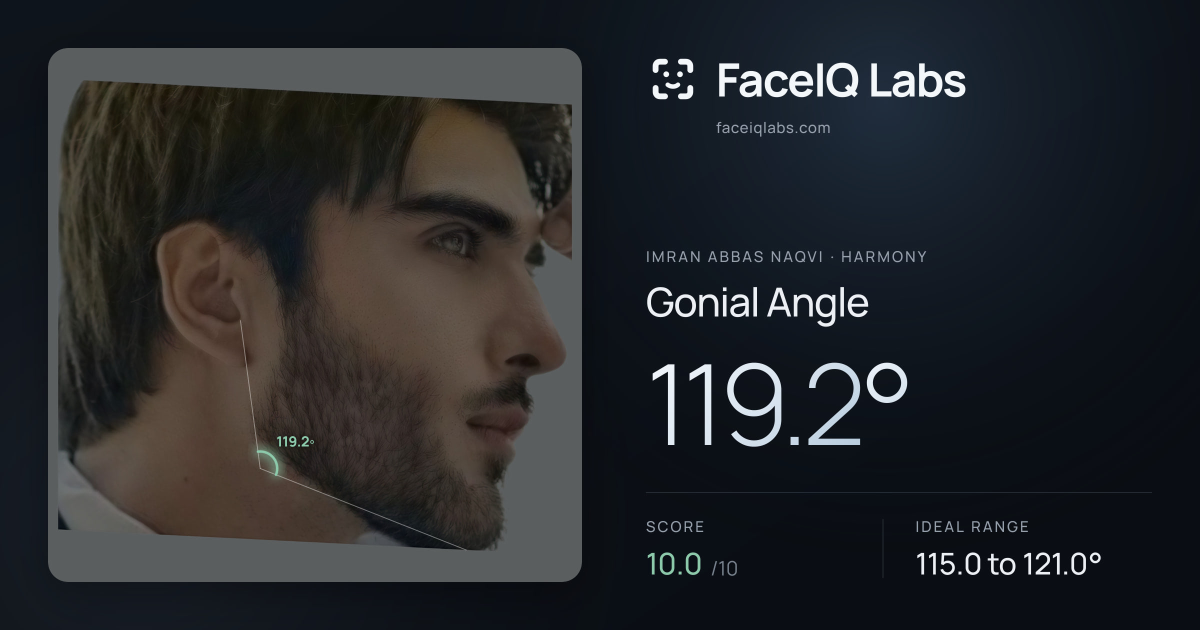 Imran Abbas Naqvi Gonial Angle: 119.2°, drawn on the photo