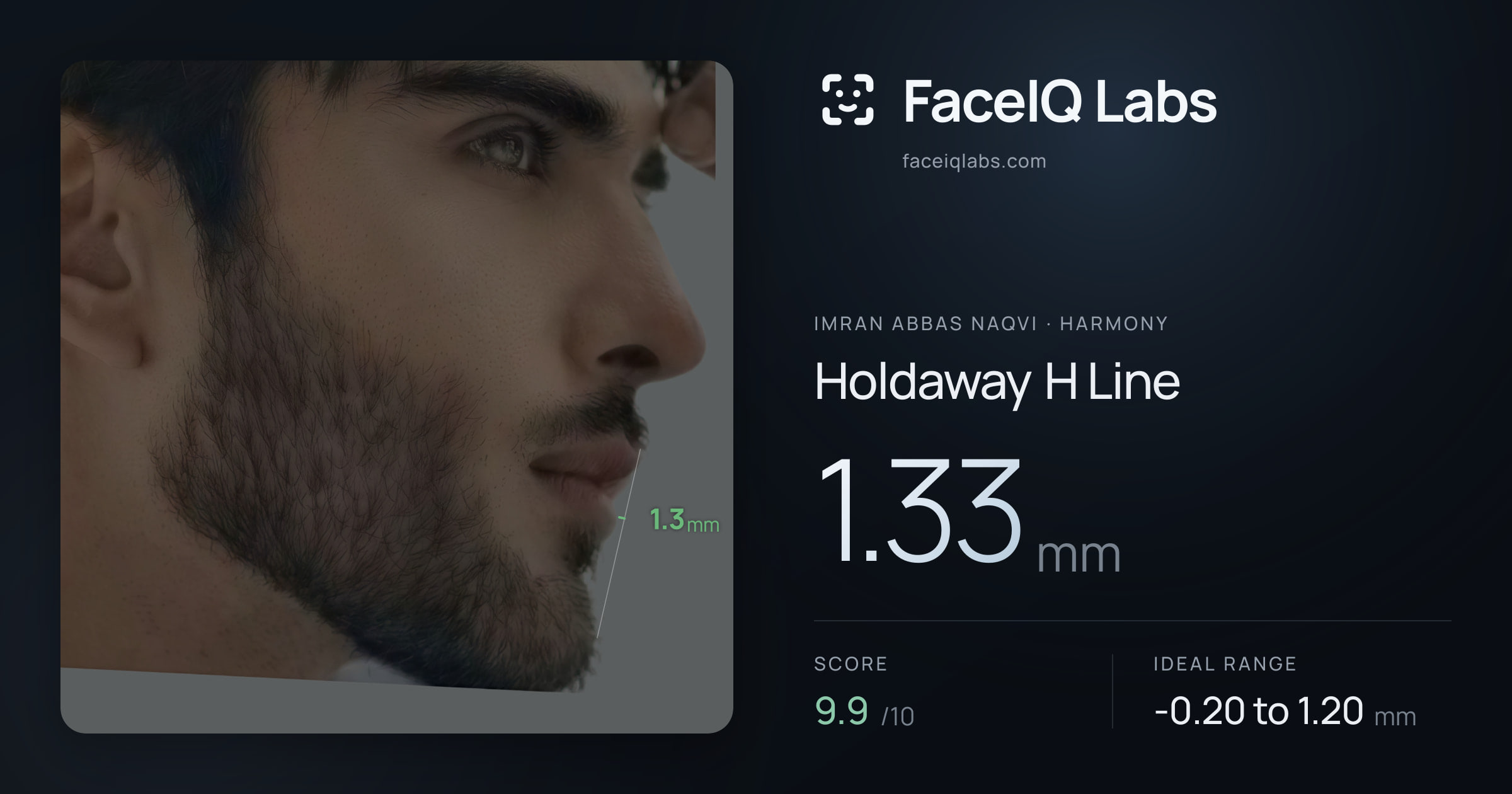 Imran Abbas Naqvi Holdaway H Line: 1.33mm, drawn on the photo