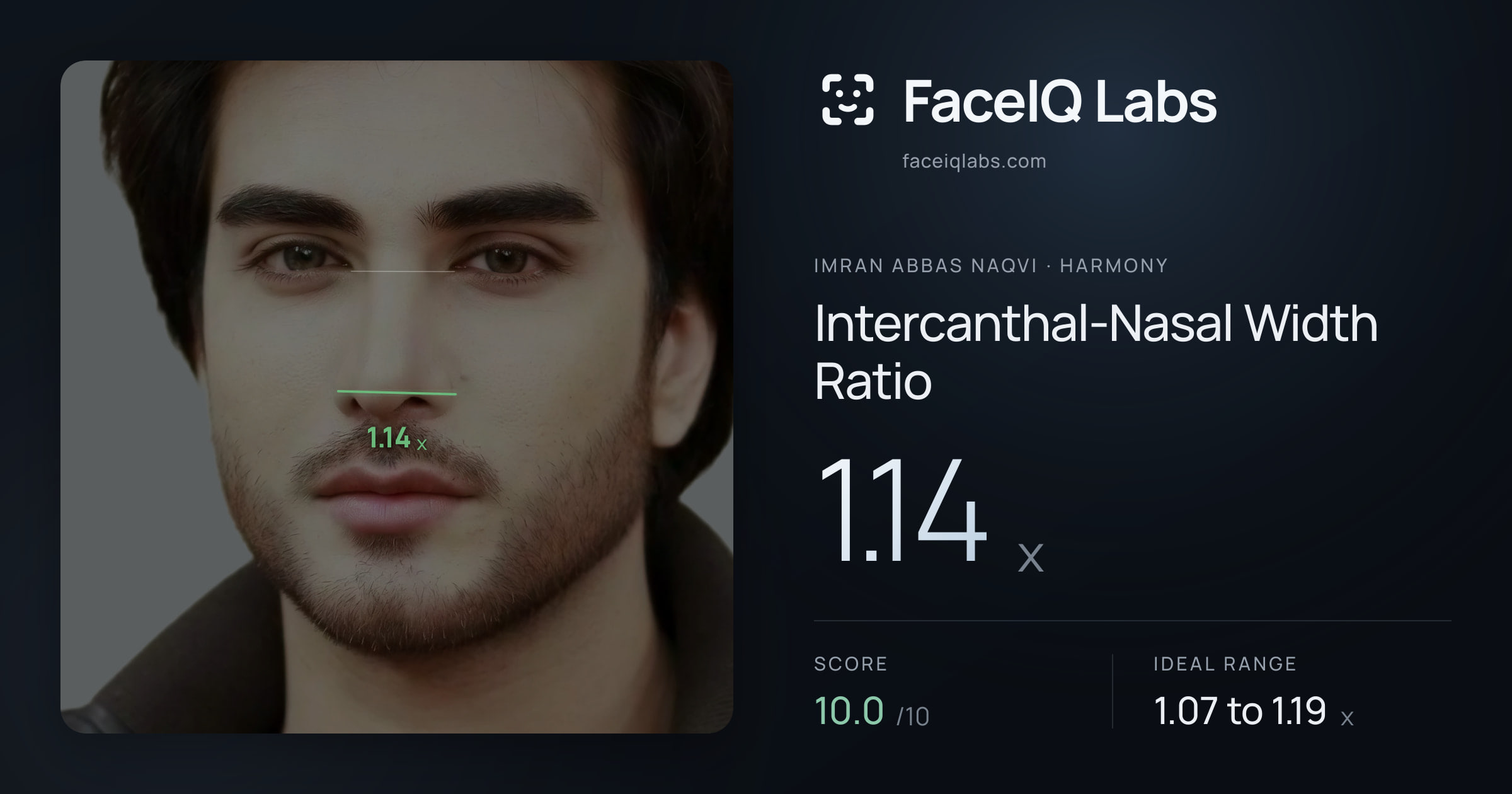 Imran Abbas Naqvi Intercanthal-Nasal Width Ratio: 1.14x, drawn on the photo