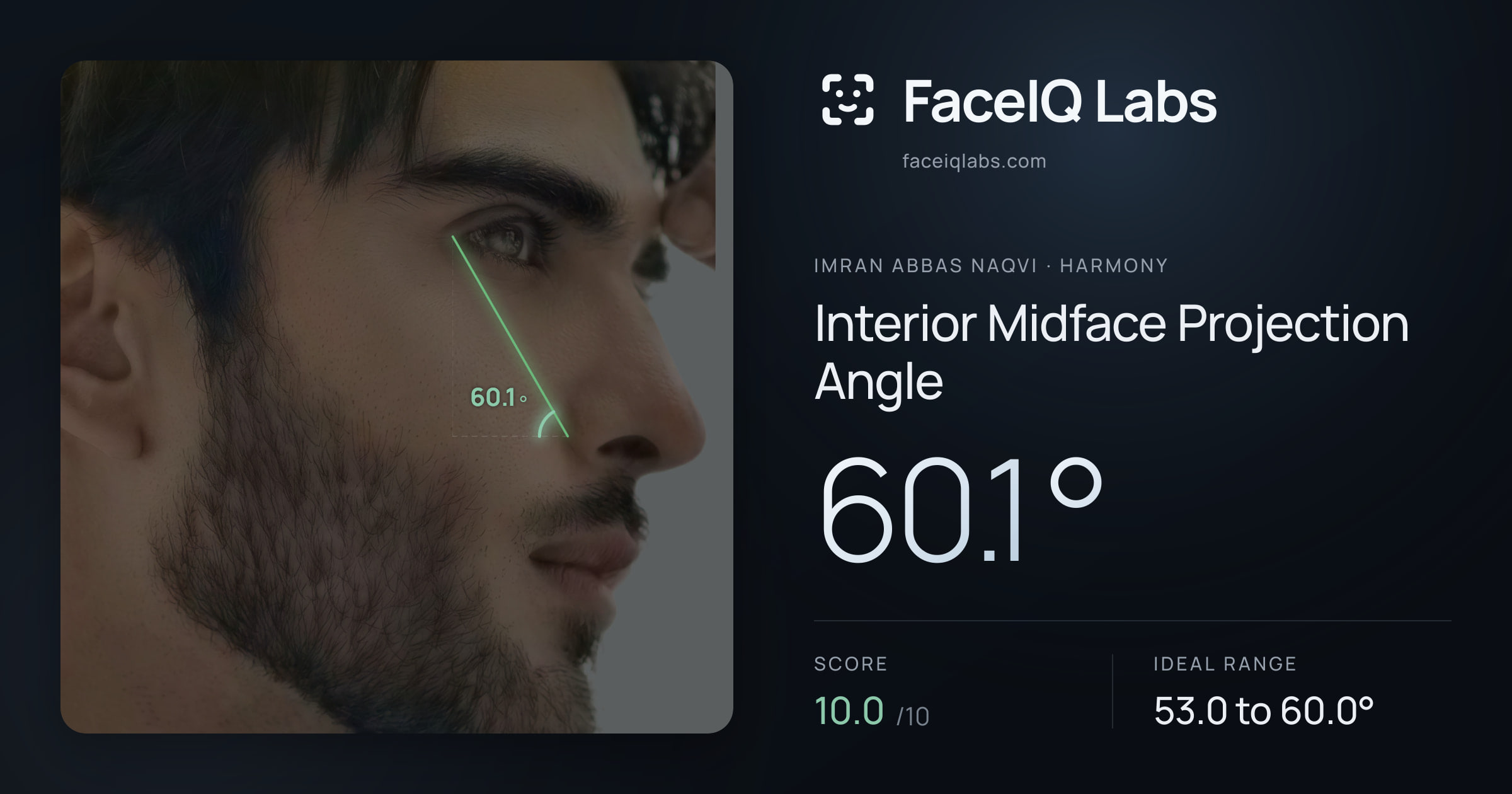 Imran Abbas Naqvi Interior Midface Projection Angle: 60.1°, drawn on the photo