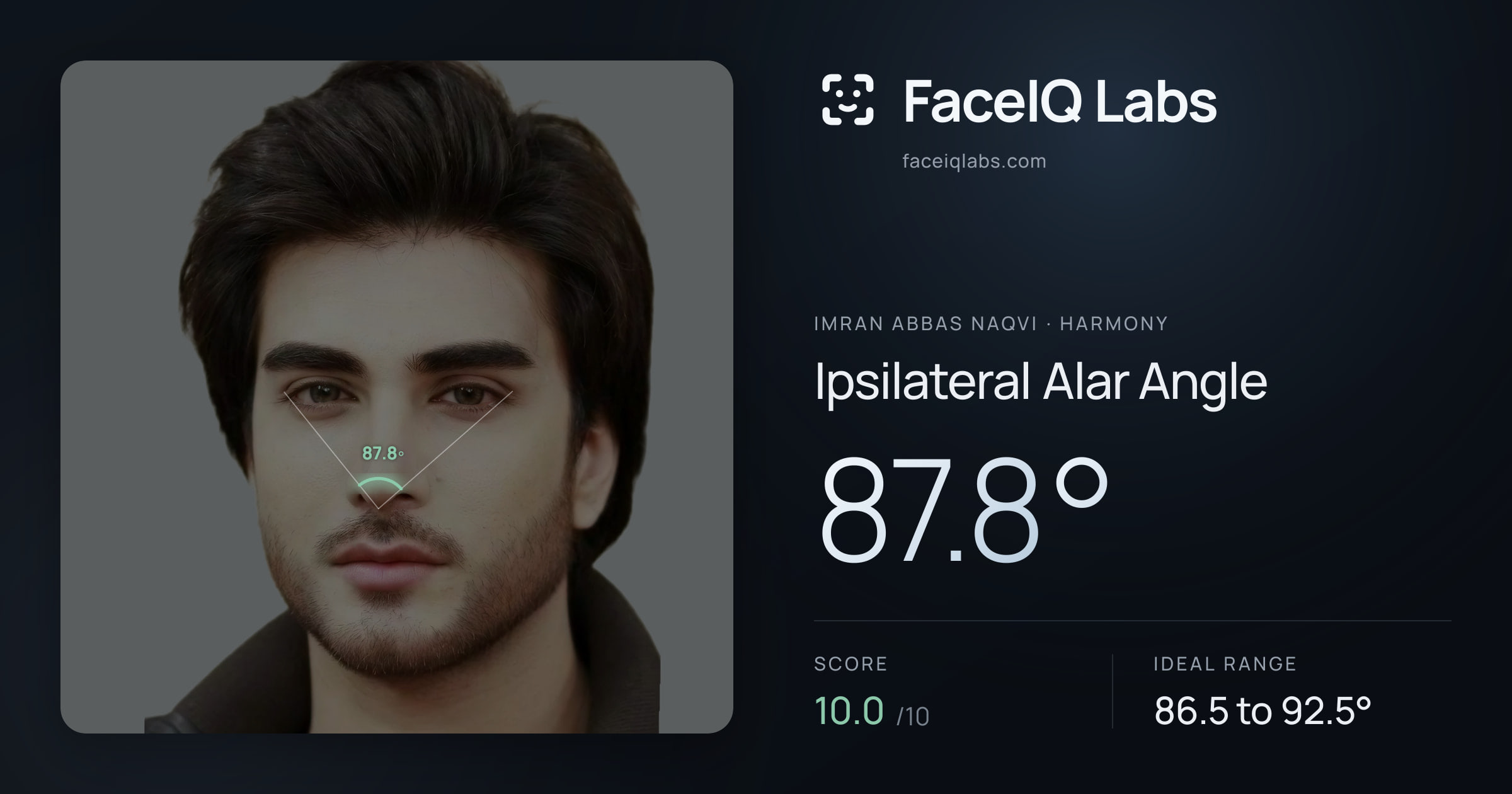 Imran Abbas Naqvi Ipsilateral Alar Angle: 87.8°, drawn on the photo