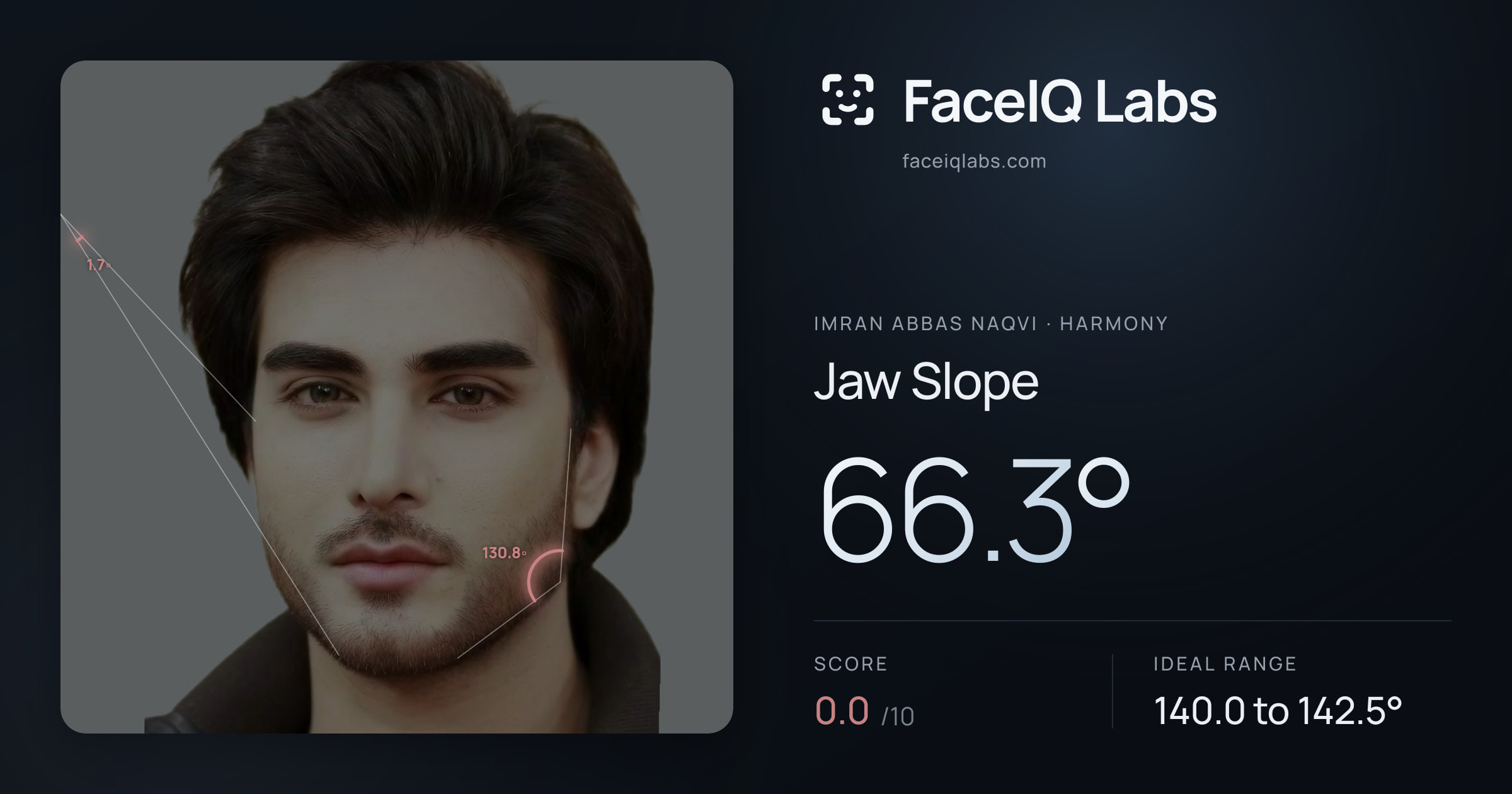 Imran Abbas Naqvi Jaw Slope: 66.3°, drawn on the photo