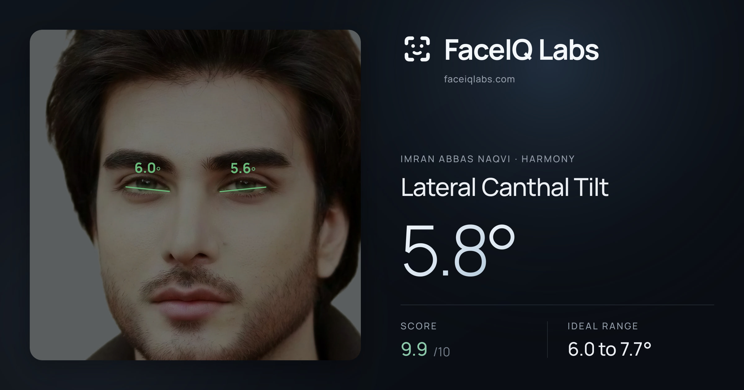 Imran Abbas Naqvi Lateral Canthal Tilt: 5.8°, drawn on the photo