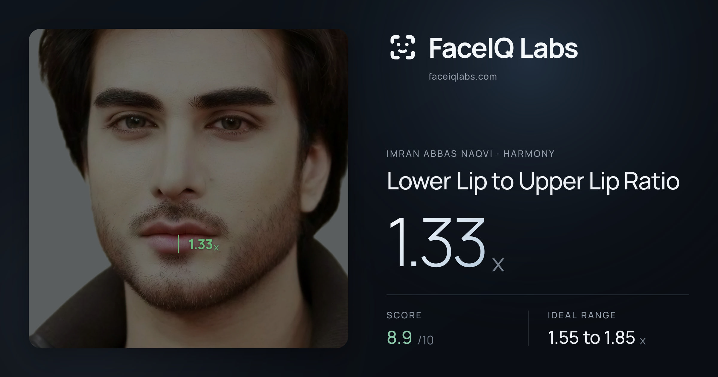Imran Abbas Naqvi Lower Lip to Upper Lip Ratio: 1.33x, drawn on the photo