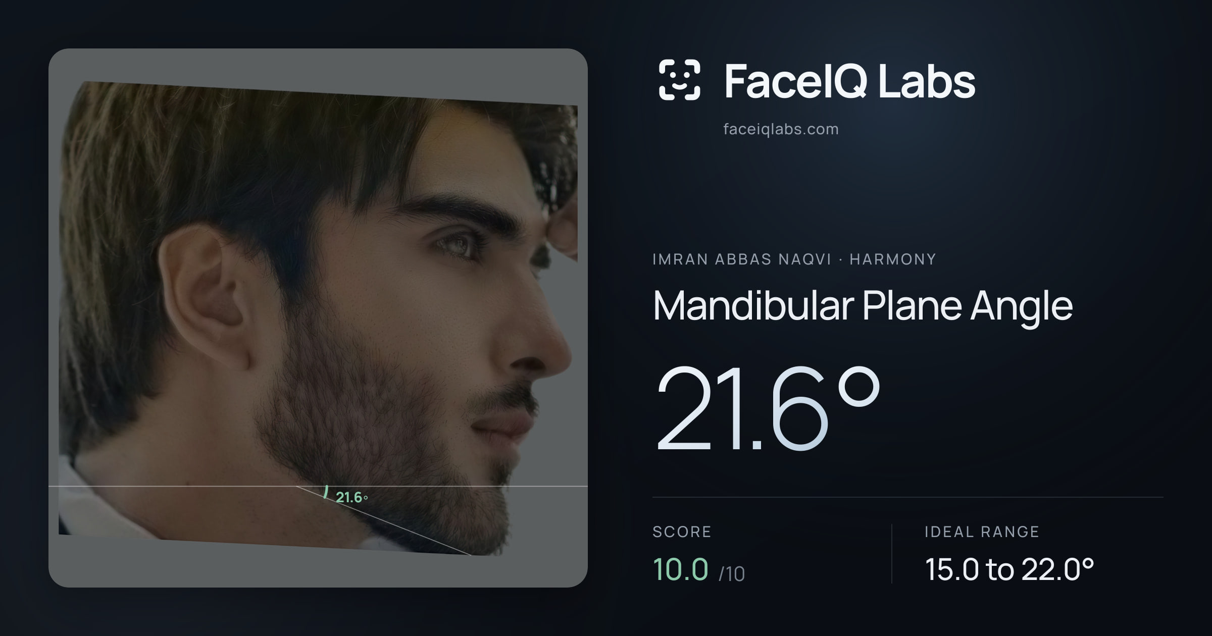 Imran Abbas Naqvi Mandibular Plane Angle: 21.6°, drawn on the photo