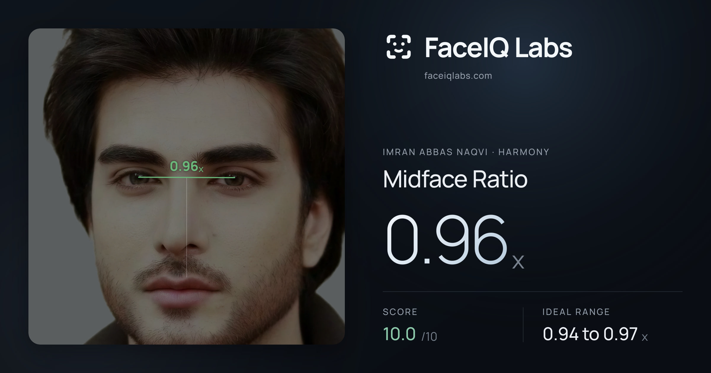 Imran Abbas Naqvi Midface Ratio: 0.96x, drawn on the photo