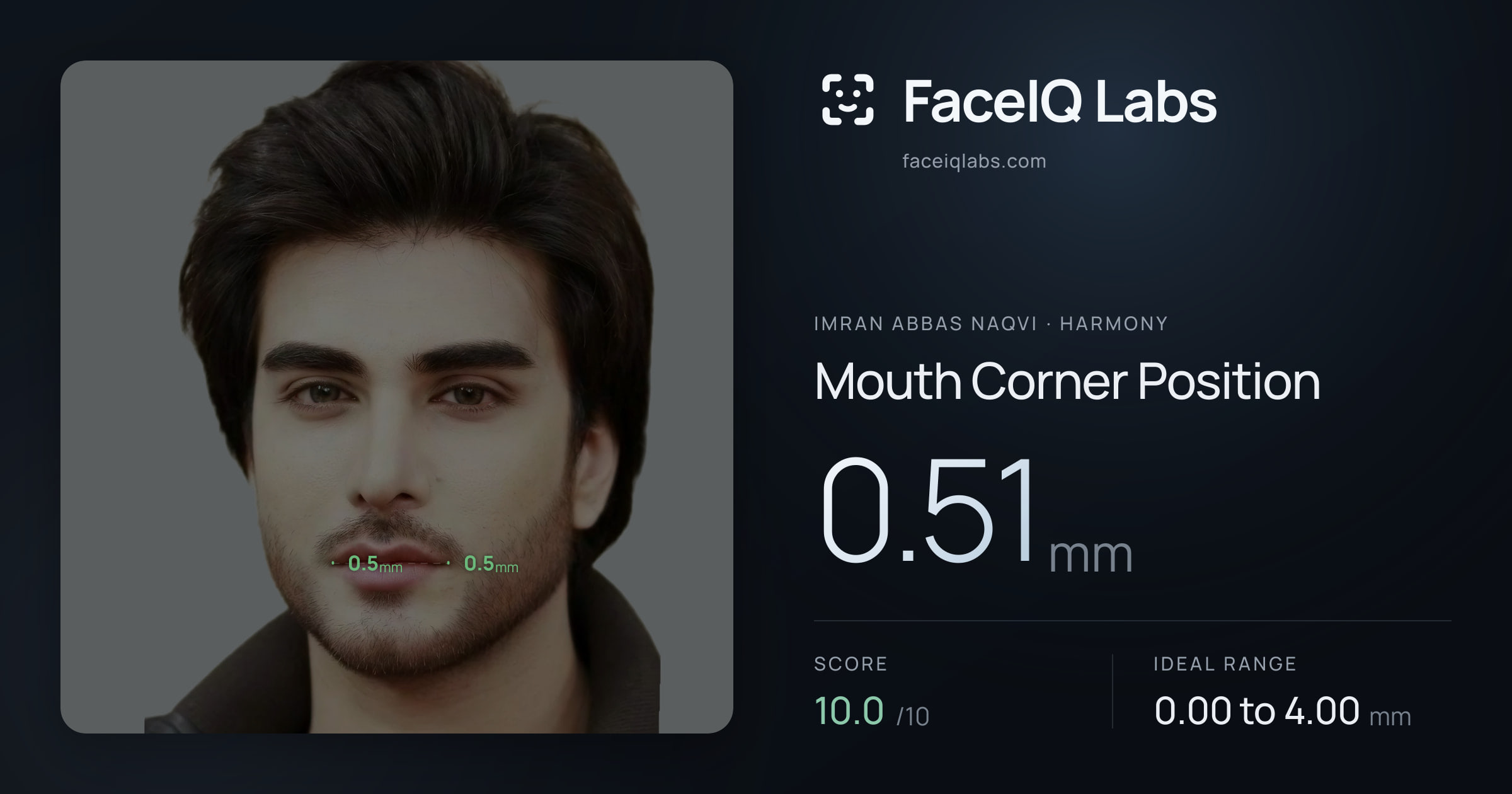 Imran Abbas Naqvi Mouth Corner Position: 0.51mm, drawn on the photo