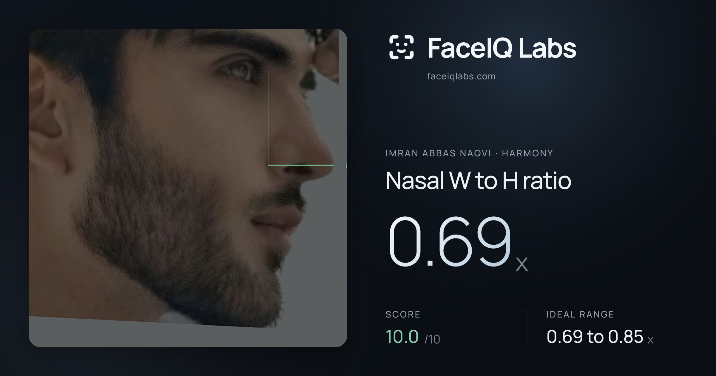 Imran Abbas Naqvi Nasal W to H ratio: 0.69x, drawn on the photo