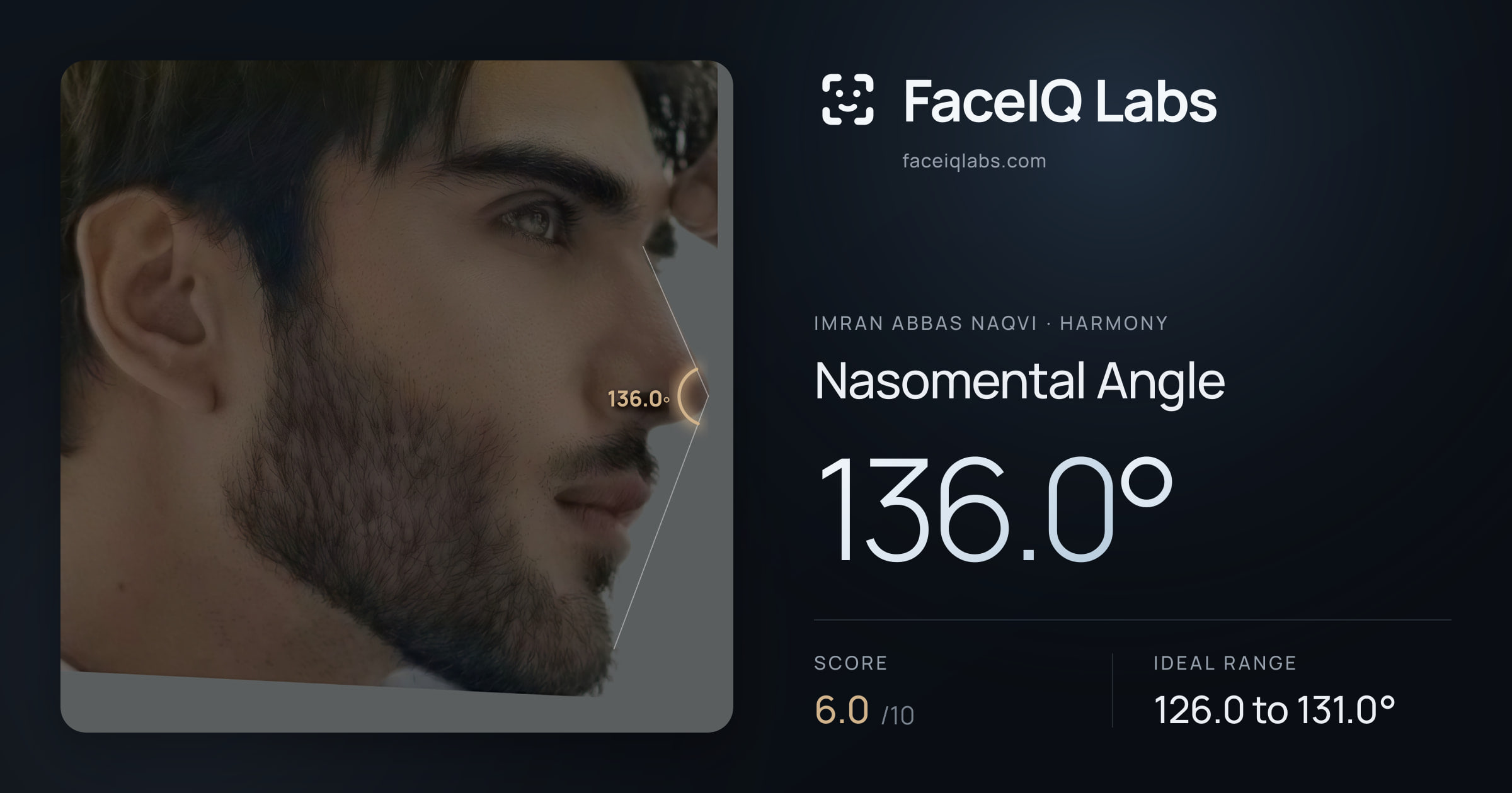 Imran Abbas Naqvi Nasomental Angle: 136.0°, drawn on the photo