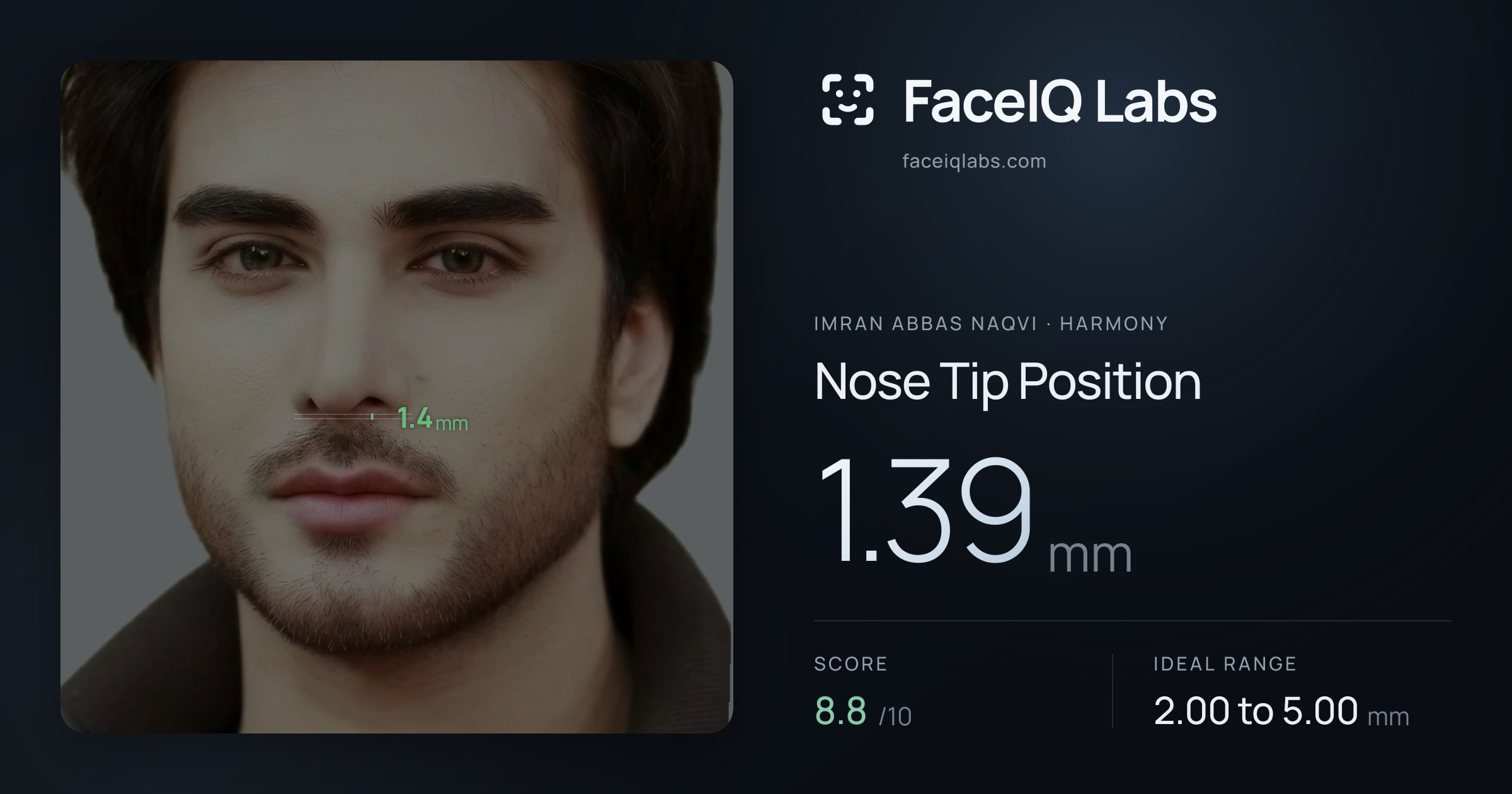 Imran Abbas Naqvi Nose Tip Position: 1.39mm, drawn on the photo