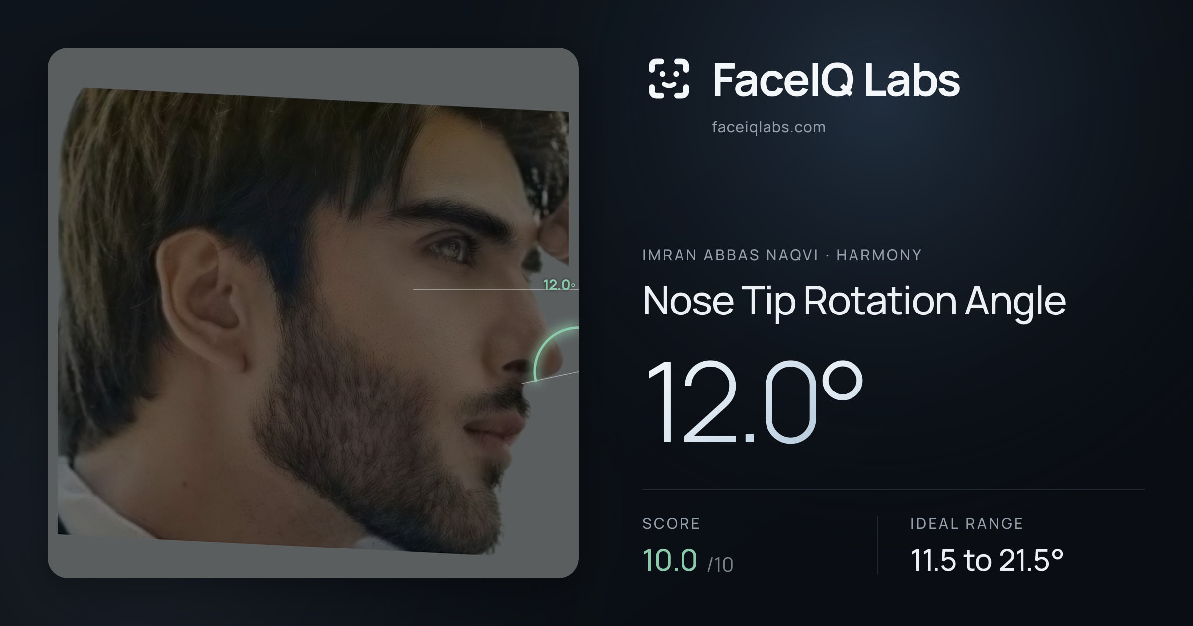 Imran Abbas Naqvi Nose Tip Rotation Angle: 12.0°, drawn on the photo