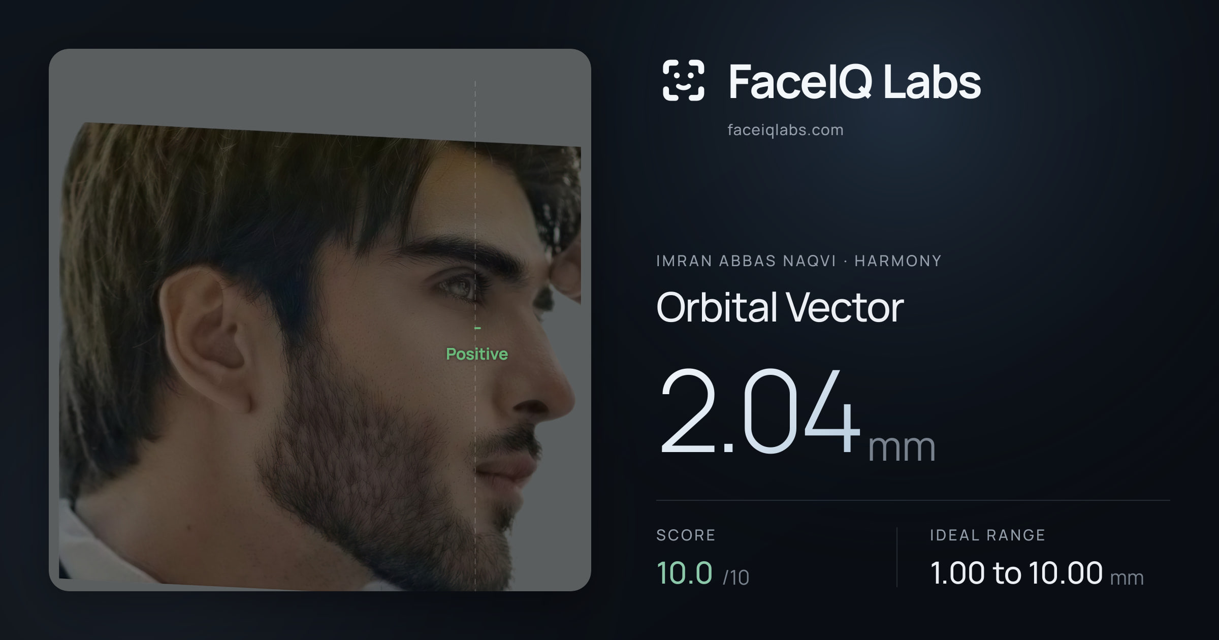 Imran Abbas Naqvi Orbital Vector: 2.04mm, drawn on the photo