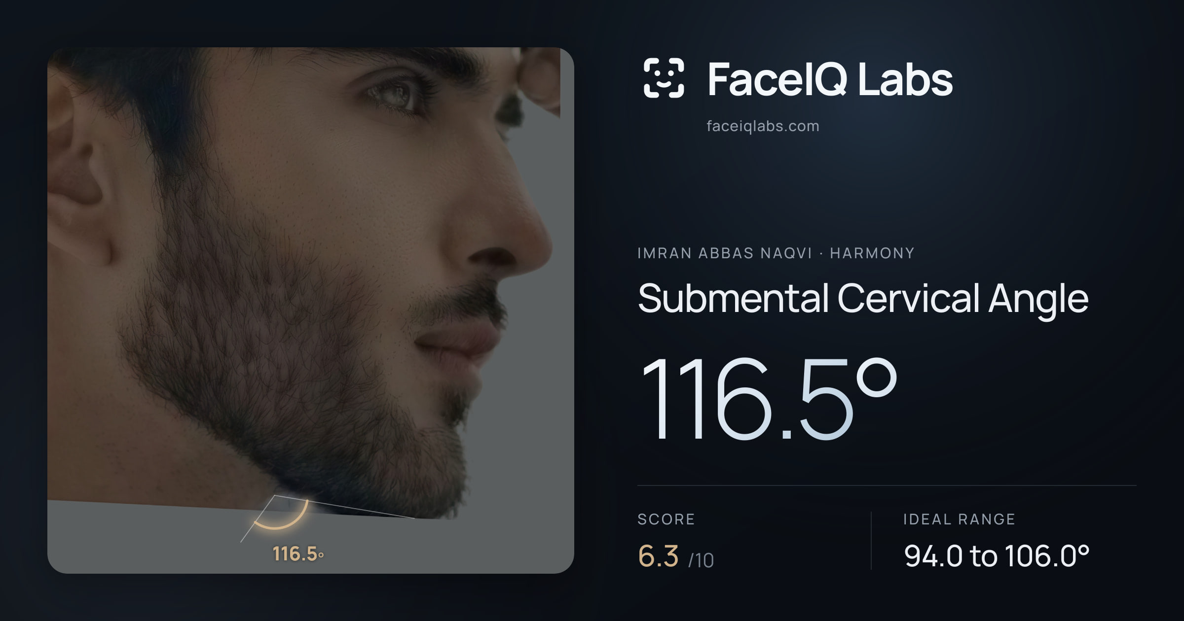 Imran Abbas Naqvi Submental Cervical Angle: 116.5°, drawn on the photo