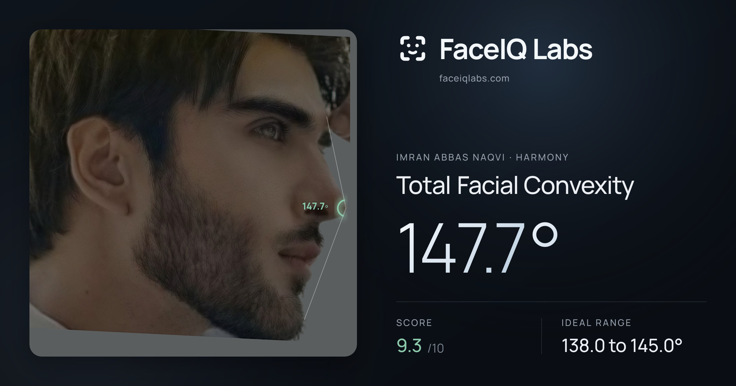 Imran Abbas Naqvi Total Facial Convexity: 147.7°, drawn on the photo