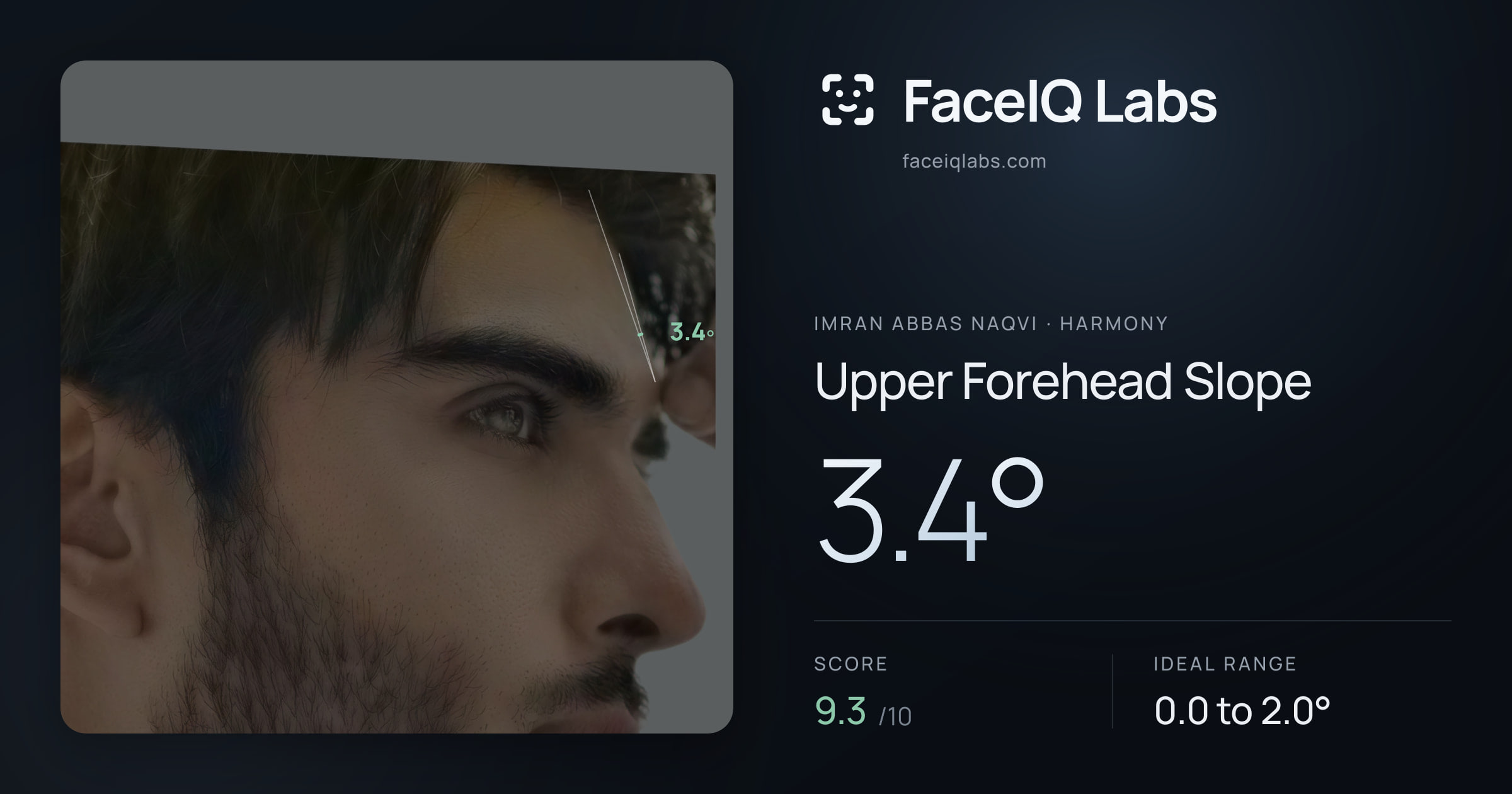 Imran Abbas Naqvi Upper Forehead Slope: 3.4°, drawn on the photo