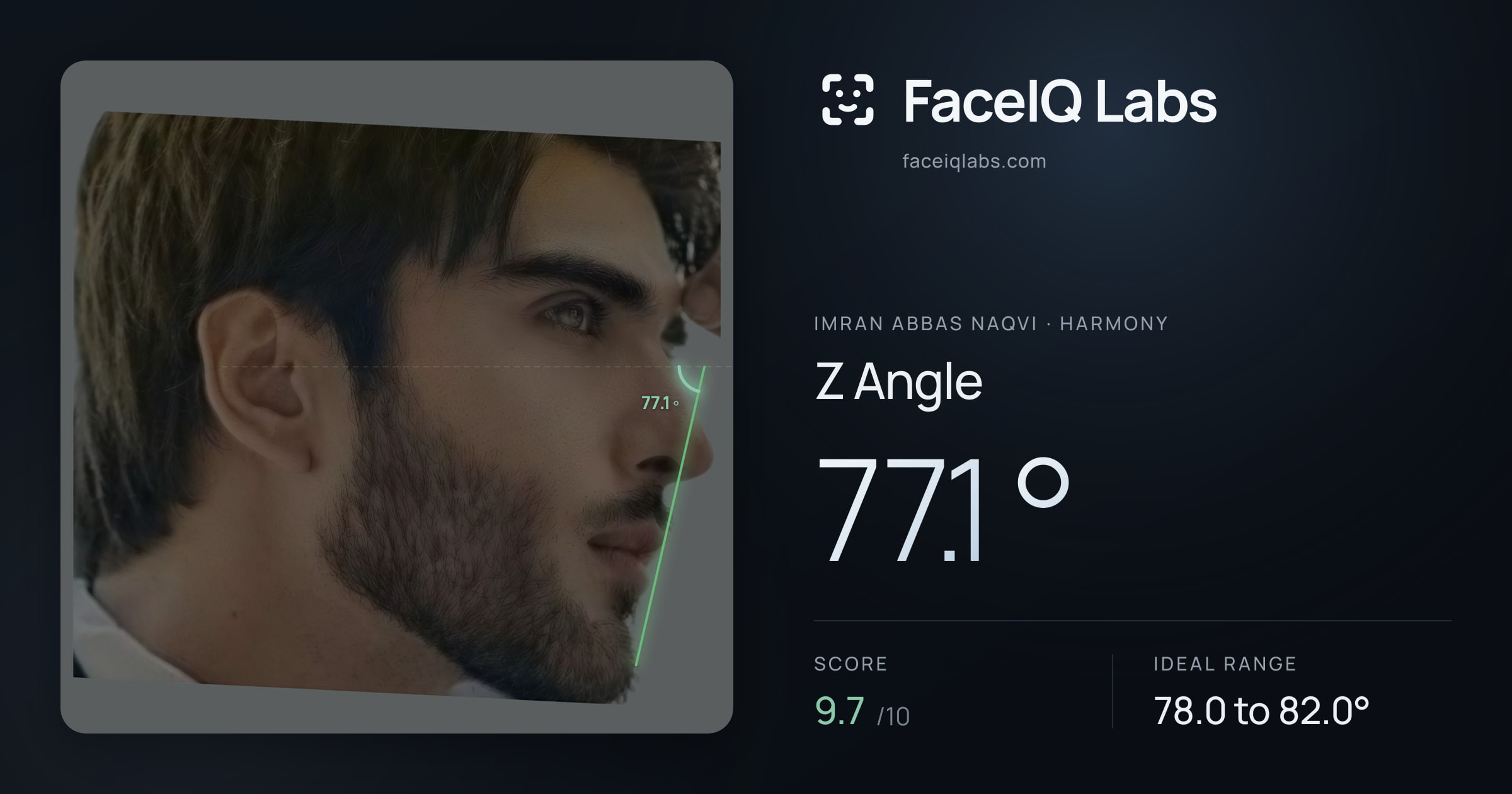 Imran Abbas Naqvi Z Angle: 77.1°, drawn on the photo
