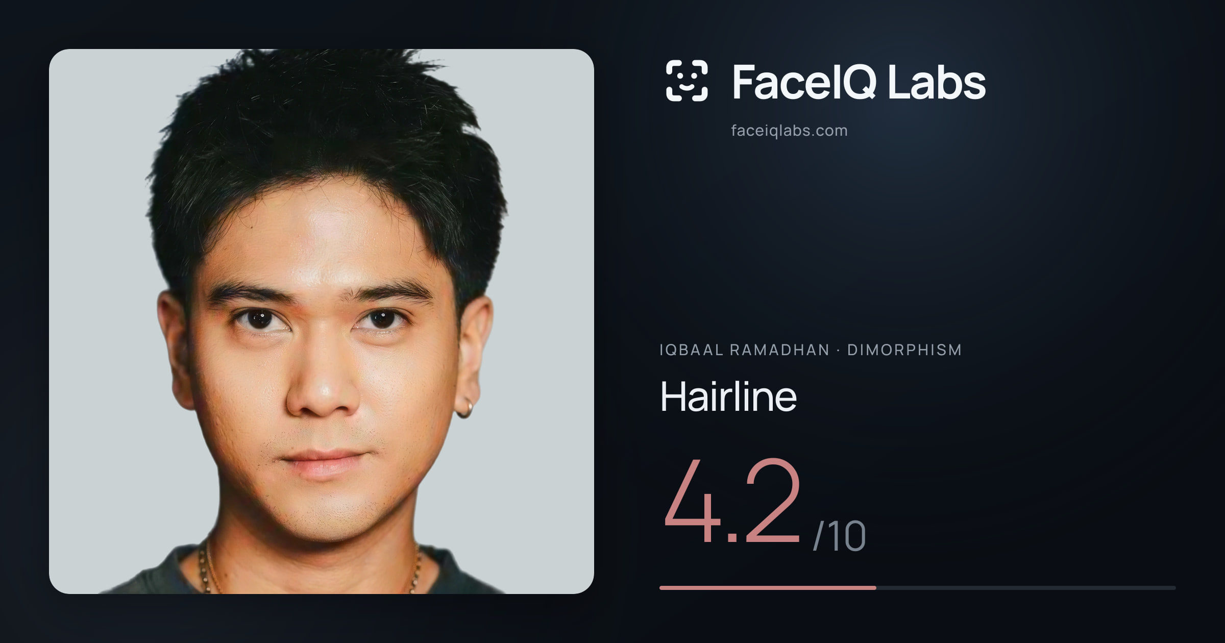 Iqbaal Ramadhan Hairline: 4.2/10, drawn on the photo