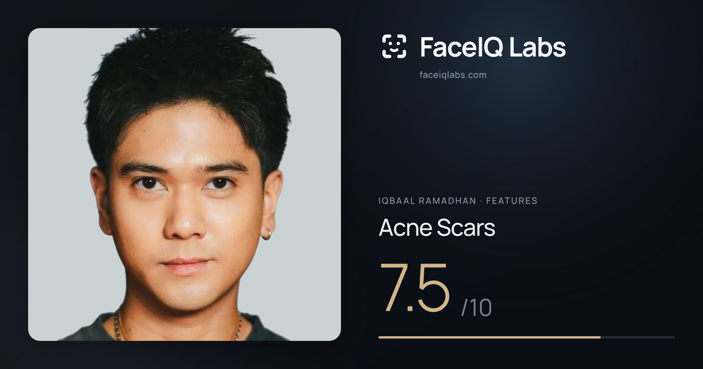 Iqbaal Ramadhan Acne Scars: 7.5/10, drawn on the photo
