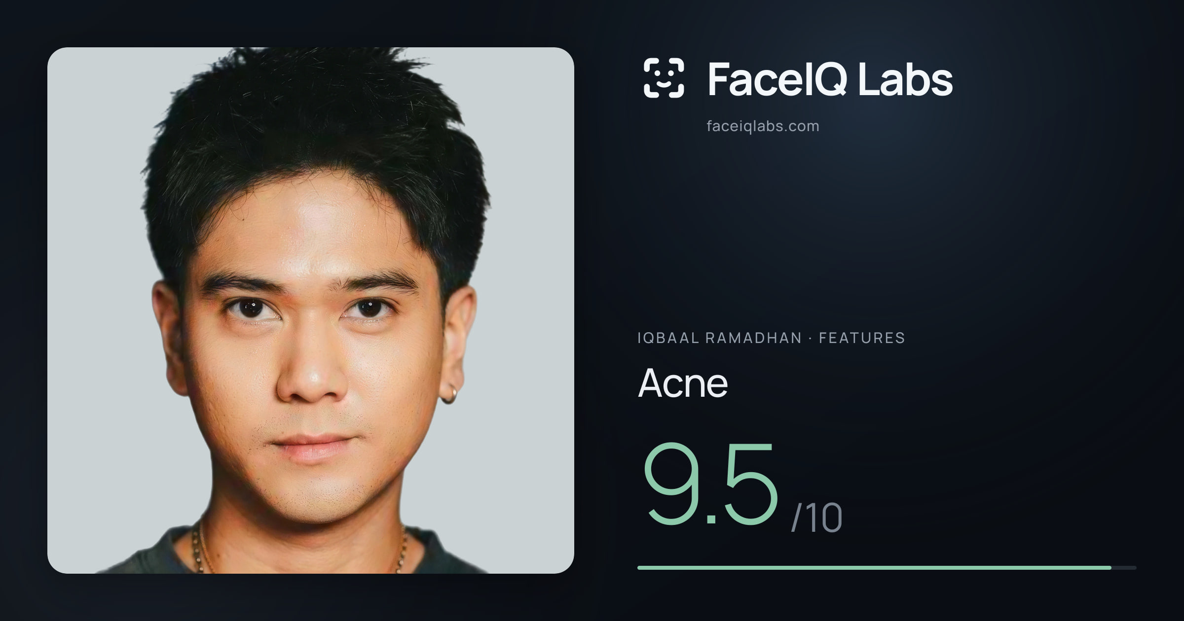 Iqbaal Ramadhan Acne: 9.5/10, drawn on the photo