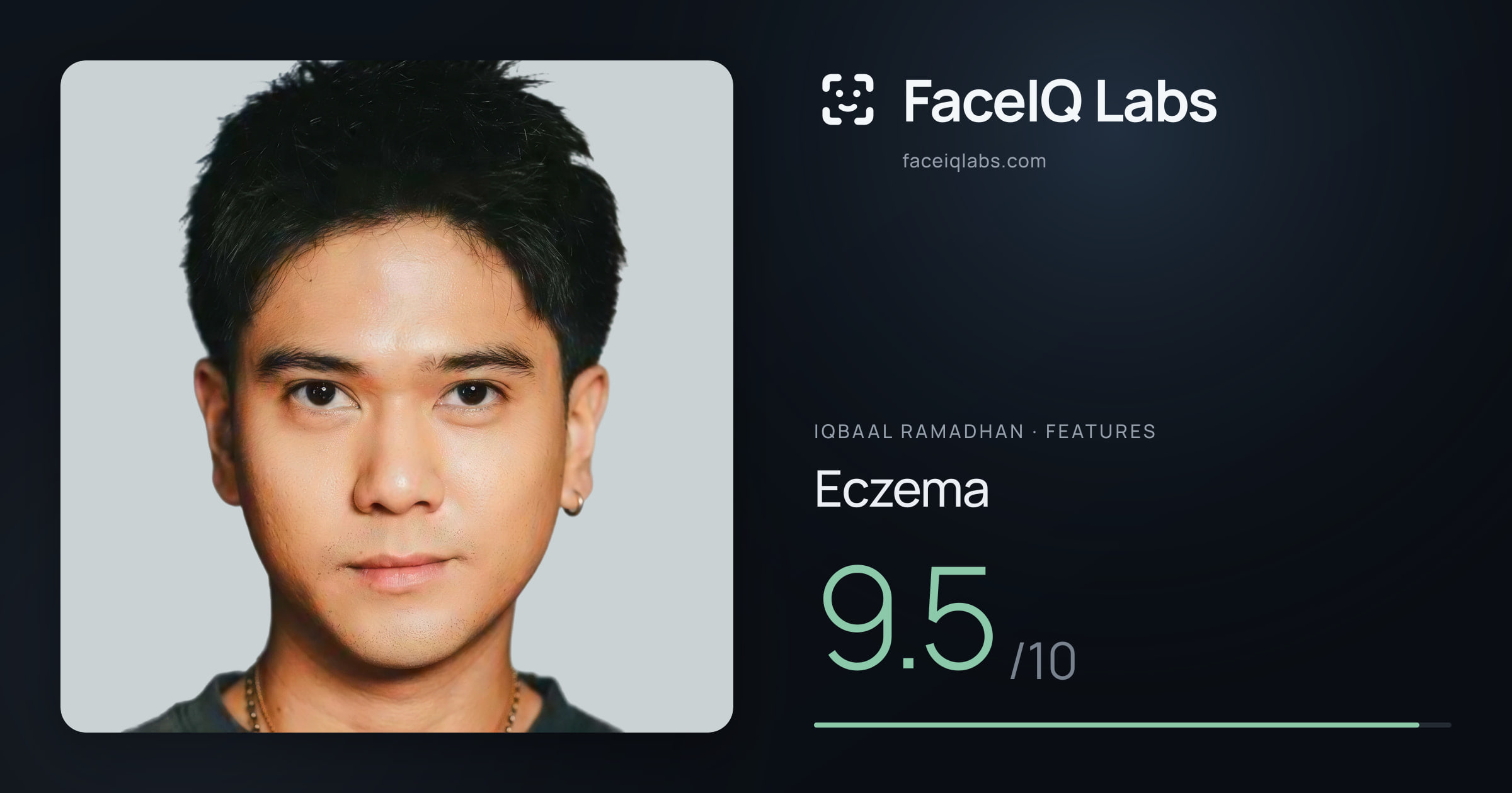 Iqbaal Ramadhan Eczema: 9.5/10, drawn on the photo
