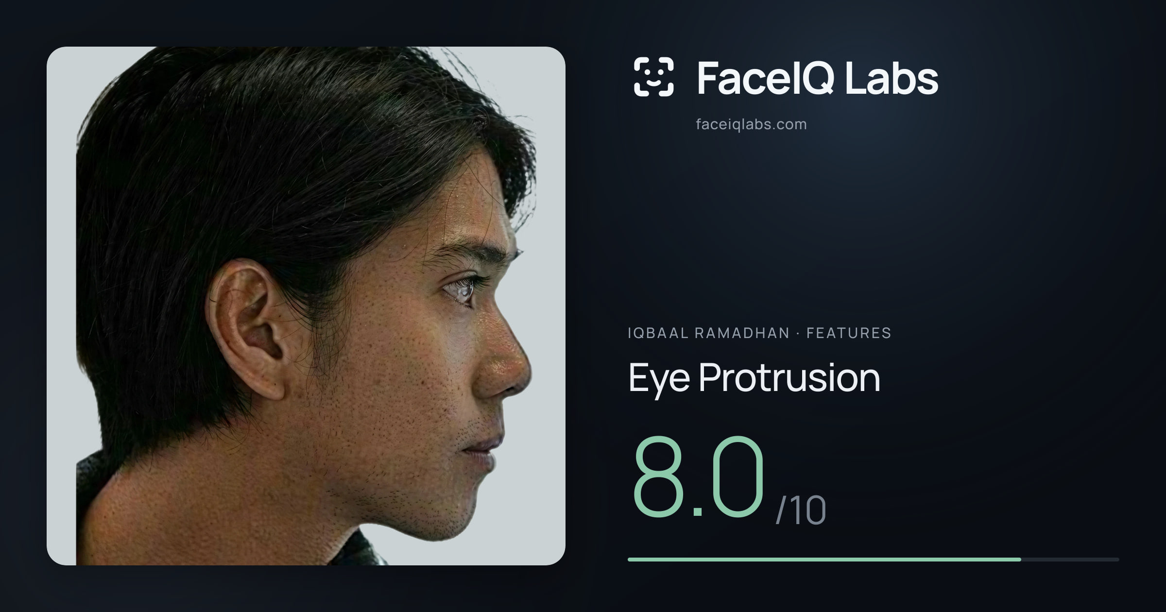 Iqbaal Ramadhan Eye Protrusion: 8.0/10, drawn on the photo