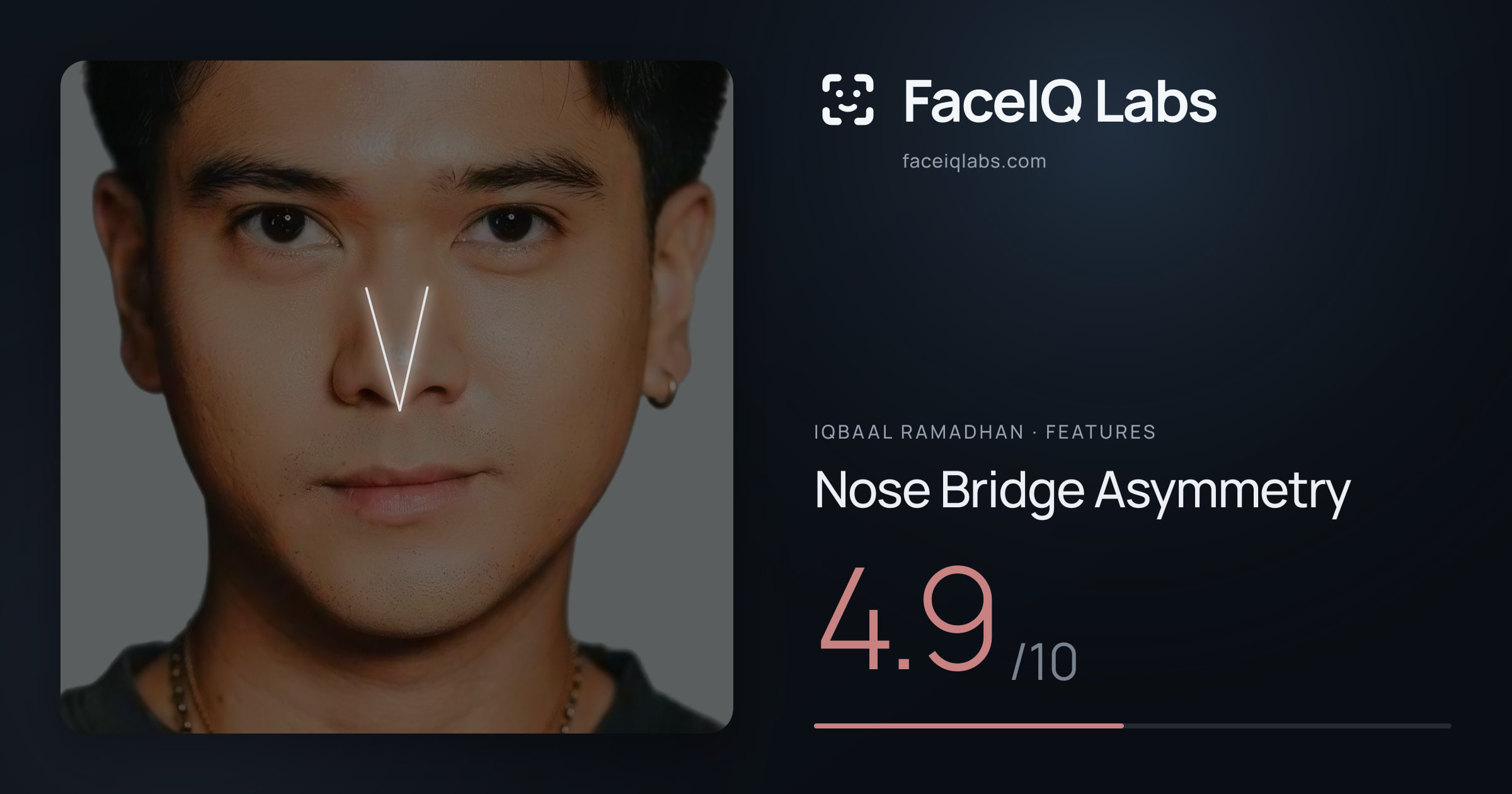 Iqbaal Ramadhan Nose Bridge Asymmetry: 4.9/10, drawn on the photo