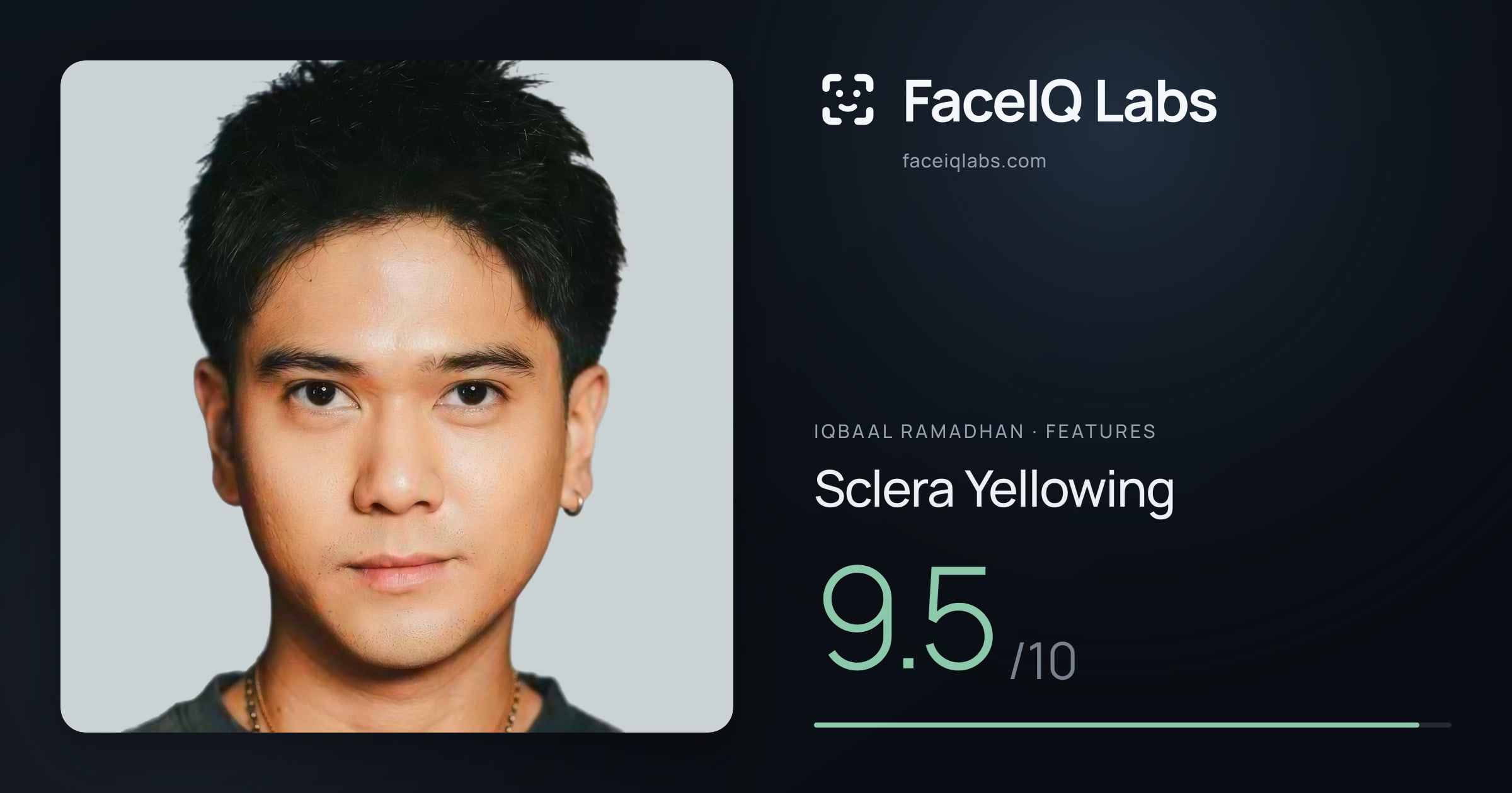 Iqbaal Ramadhan Sclera Yellowing: 9.5/10, drawn on the photo