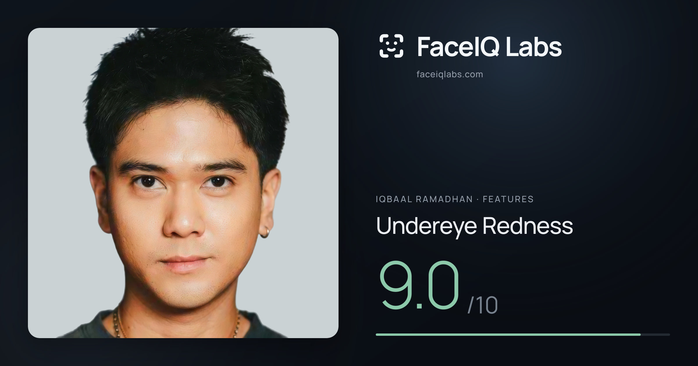 Iqbaal Ramadhan Undereye Redness: 9.0/10, drawn on the photo