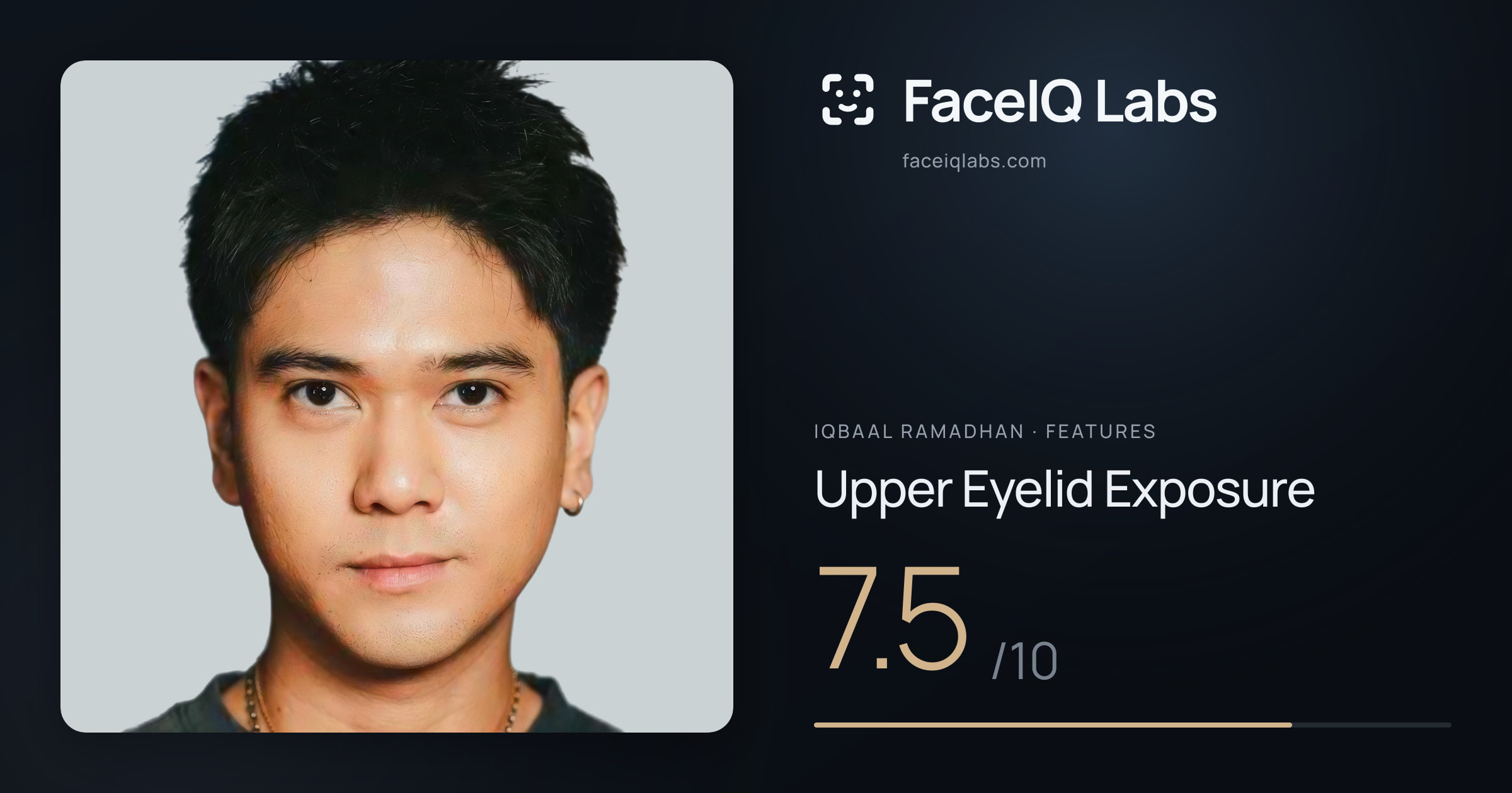 Iqbaal Ramadhan Upper Eyelid Exposure: 7.5/10, drawn on the photo