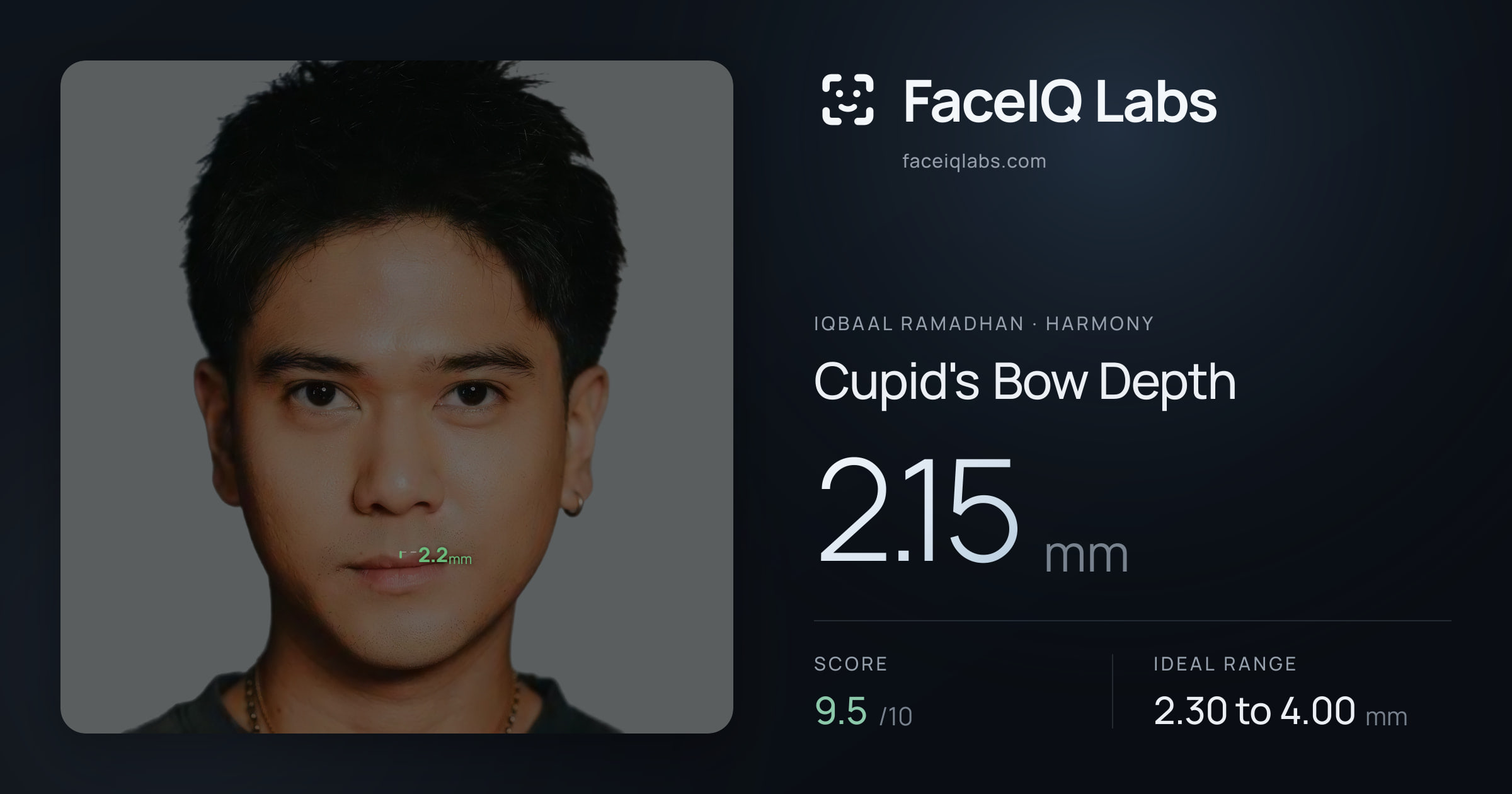 Iqbaal Ramadhan Cupid's Bow Depth: 2.15mm, drawn on the photo