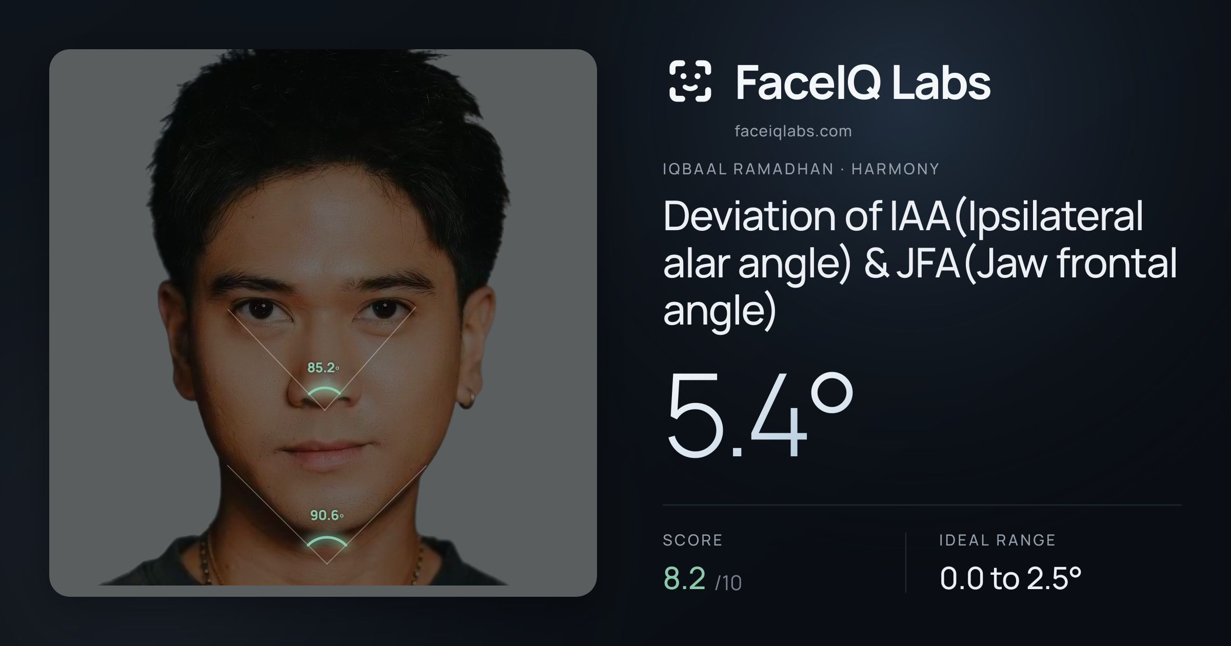 Iqbaal Ramadhan Deviation of IAA(Ipsilateral alar angle) & JFA(Jaw frontal angle): 5.4°, drawn on the photo