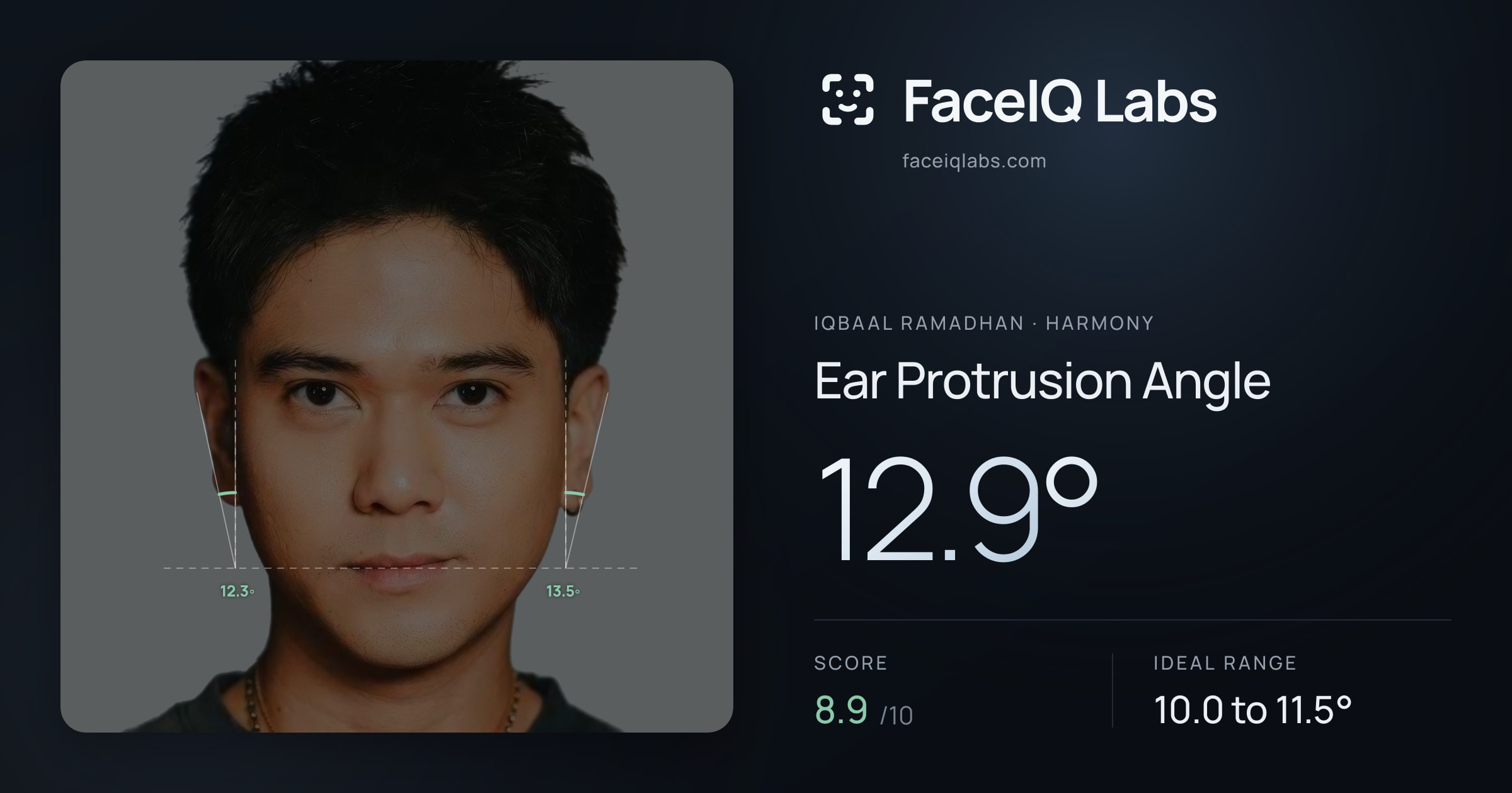 Iqbaal Ramadhan Ear Protrusion Angle: 12.9°, drawn on the photo