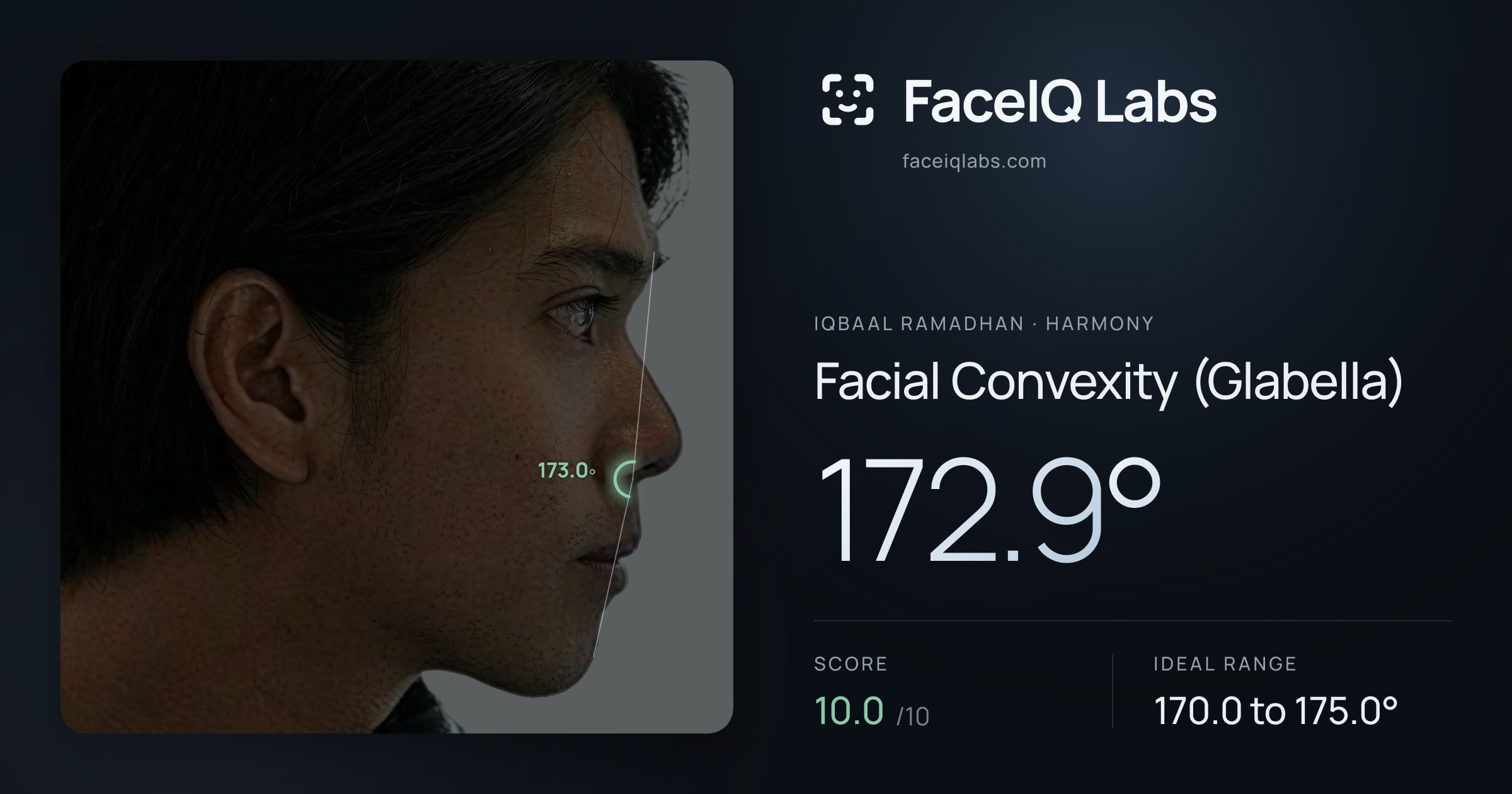 Iqbaal Ramadhan Facial Convexity (Glabella): 172.9°, drawn on the photo