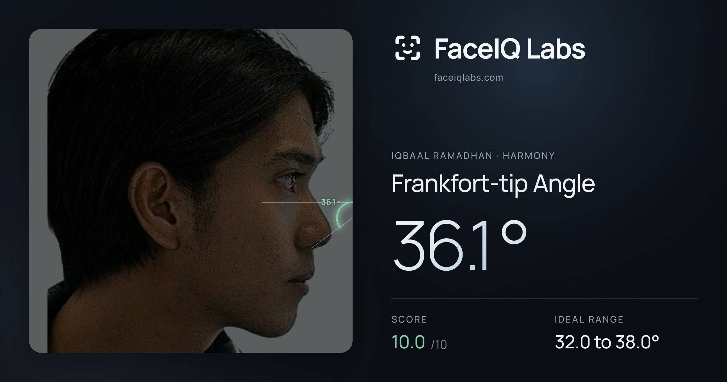 Iqbaal Ramadhan Frankfort-tip Angle: 36.1°, drawn on the photo