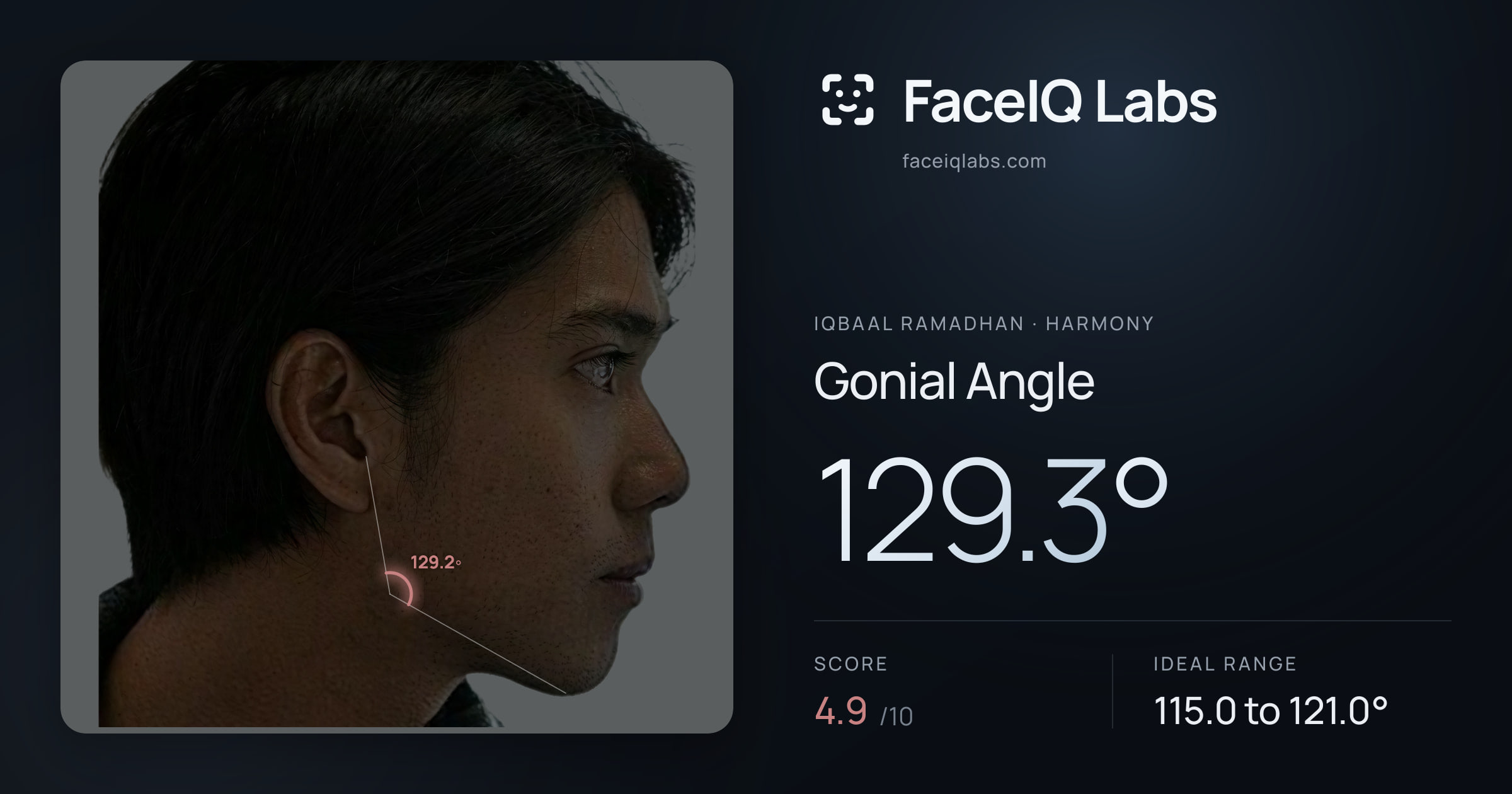 Iqbaal Ramadhan Gonial Angle: 129.3°, drawn on the photo