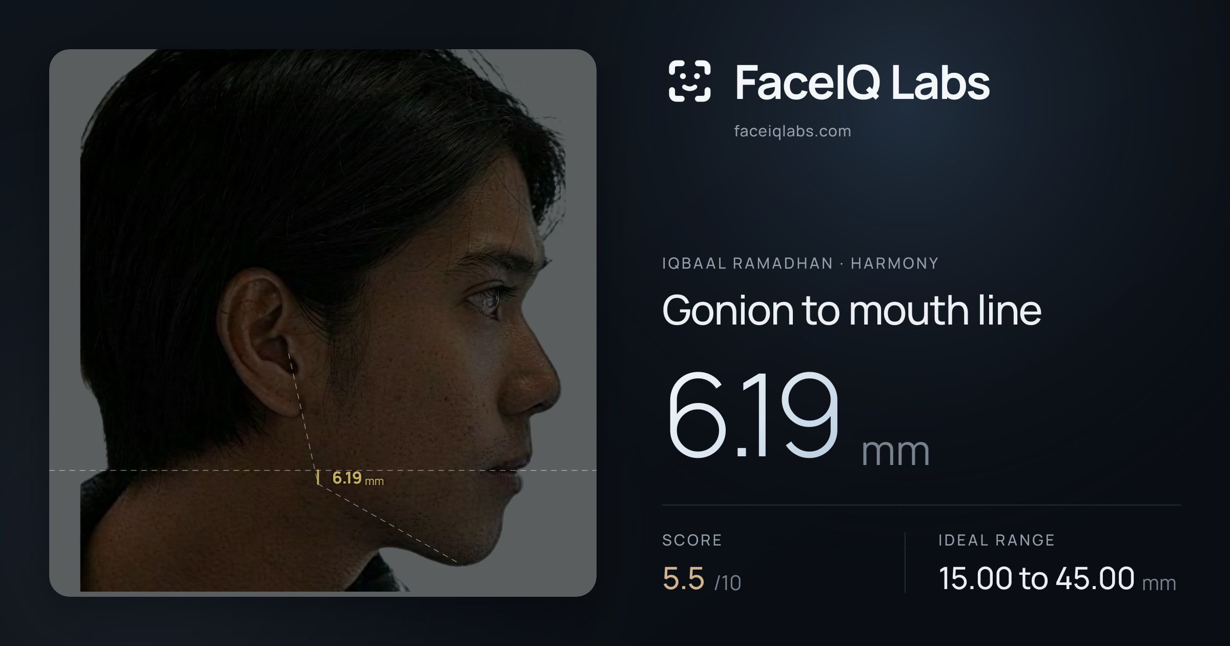 Iqbaal Ramadhan Gonion to mouth line: 6.19mm, drawn on the photo