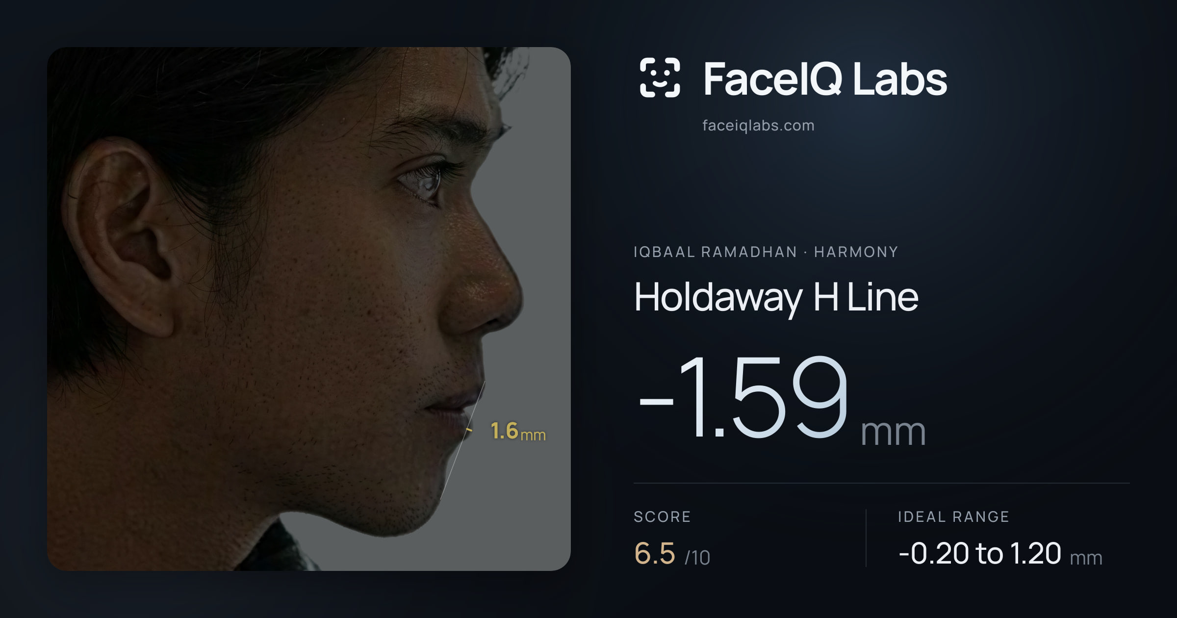 Iqbaal Ramadhan Holdaway H Line: -1.59mm, drawn on the photo