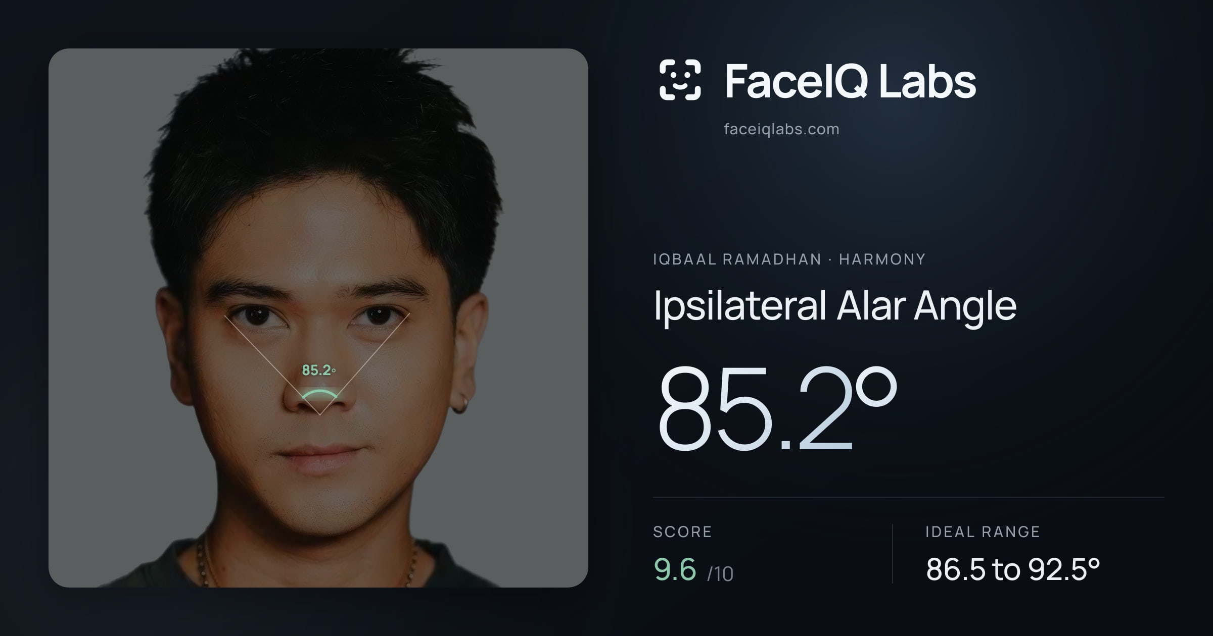 Iqbaal Ramadhan Ipsilateral Alar Angle: 85.2°, drawn on the photo