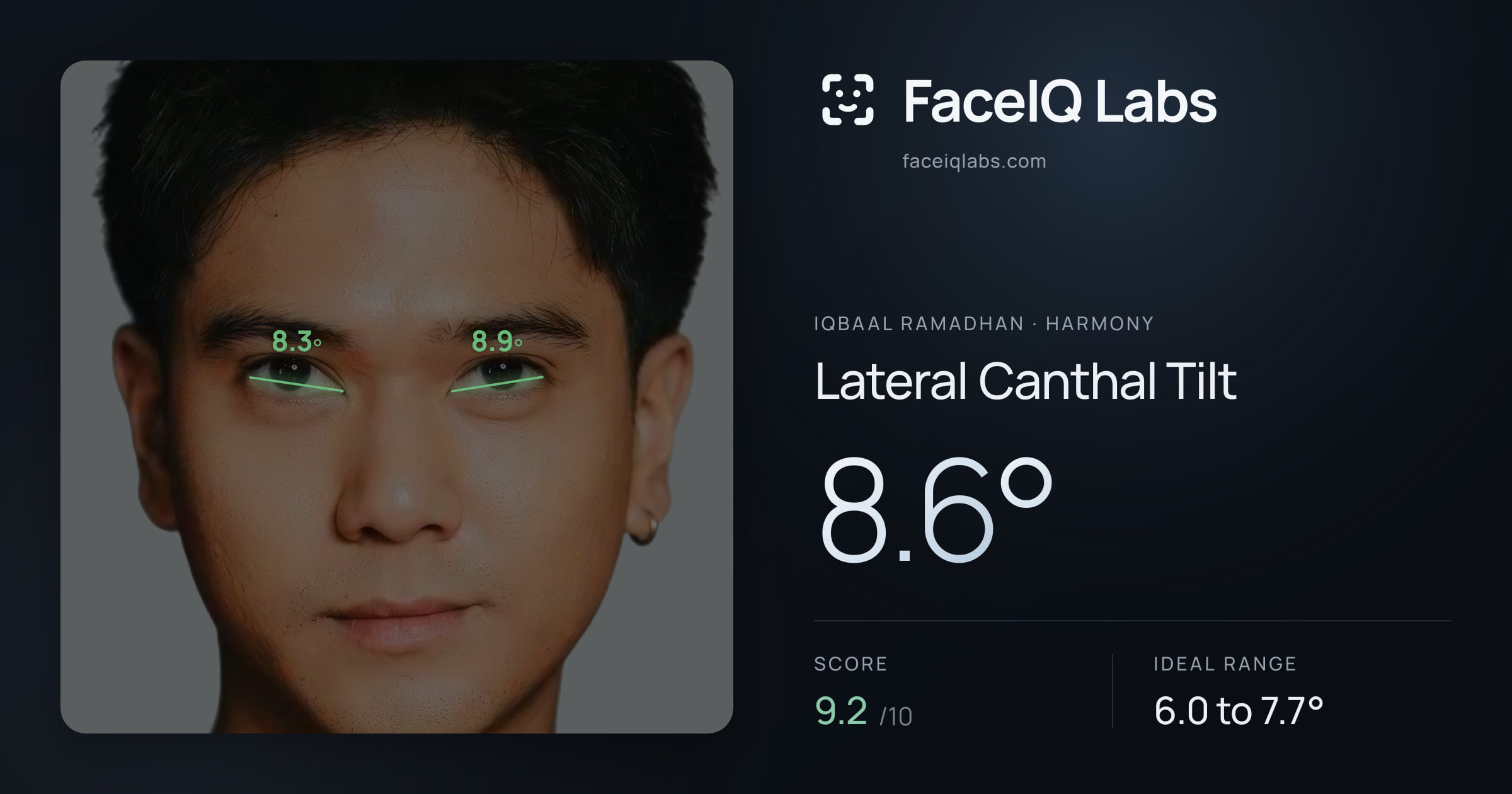 Iqbaal Ramadhan Lateral Canthal Tilt: 8.6°, drawn on the photo