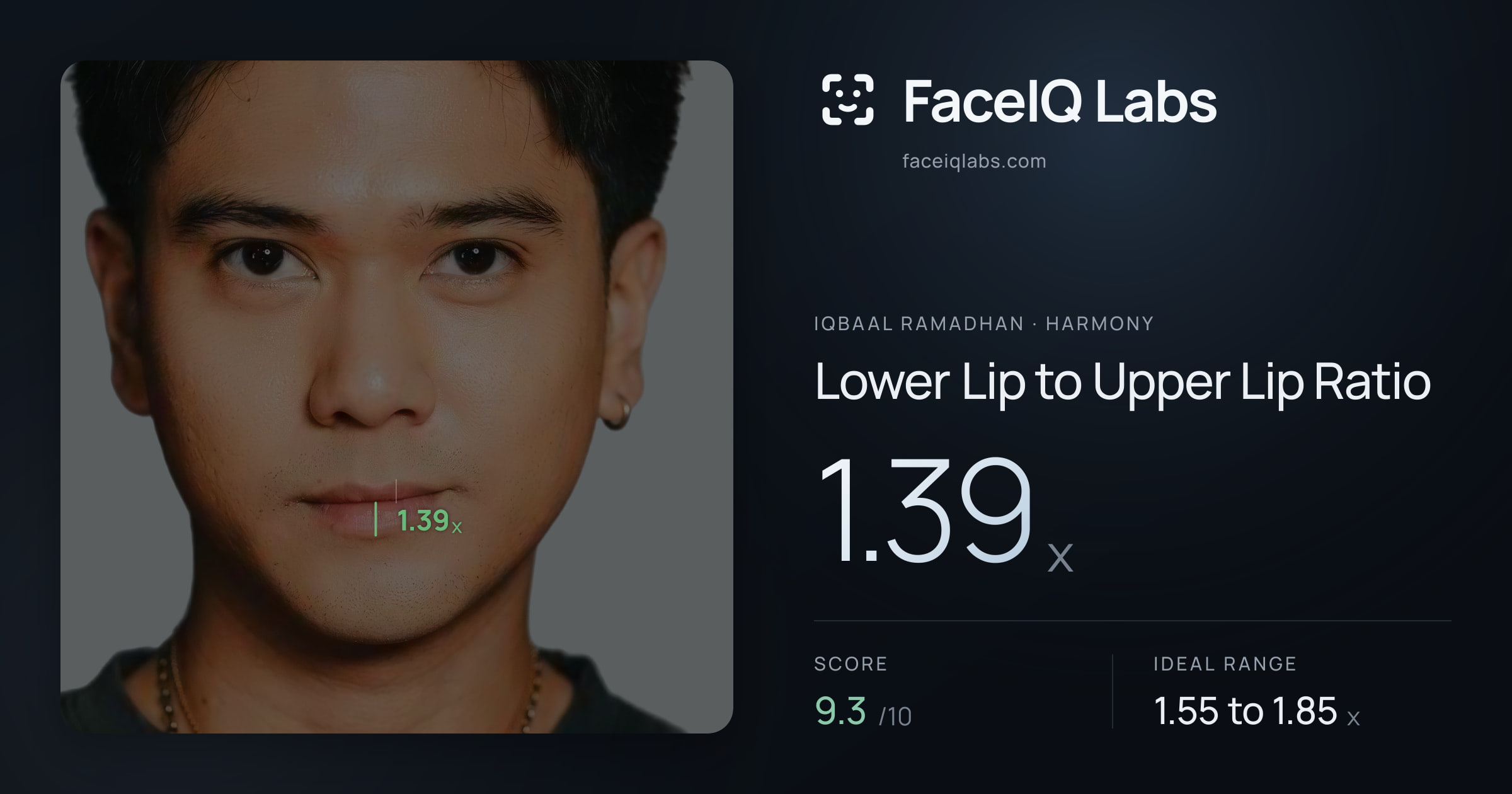 Iqbaal Ramadhan Lower Lip to Upper Lip Ratio: 1.39x, drawn on the photo