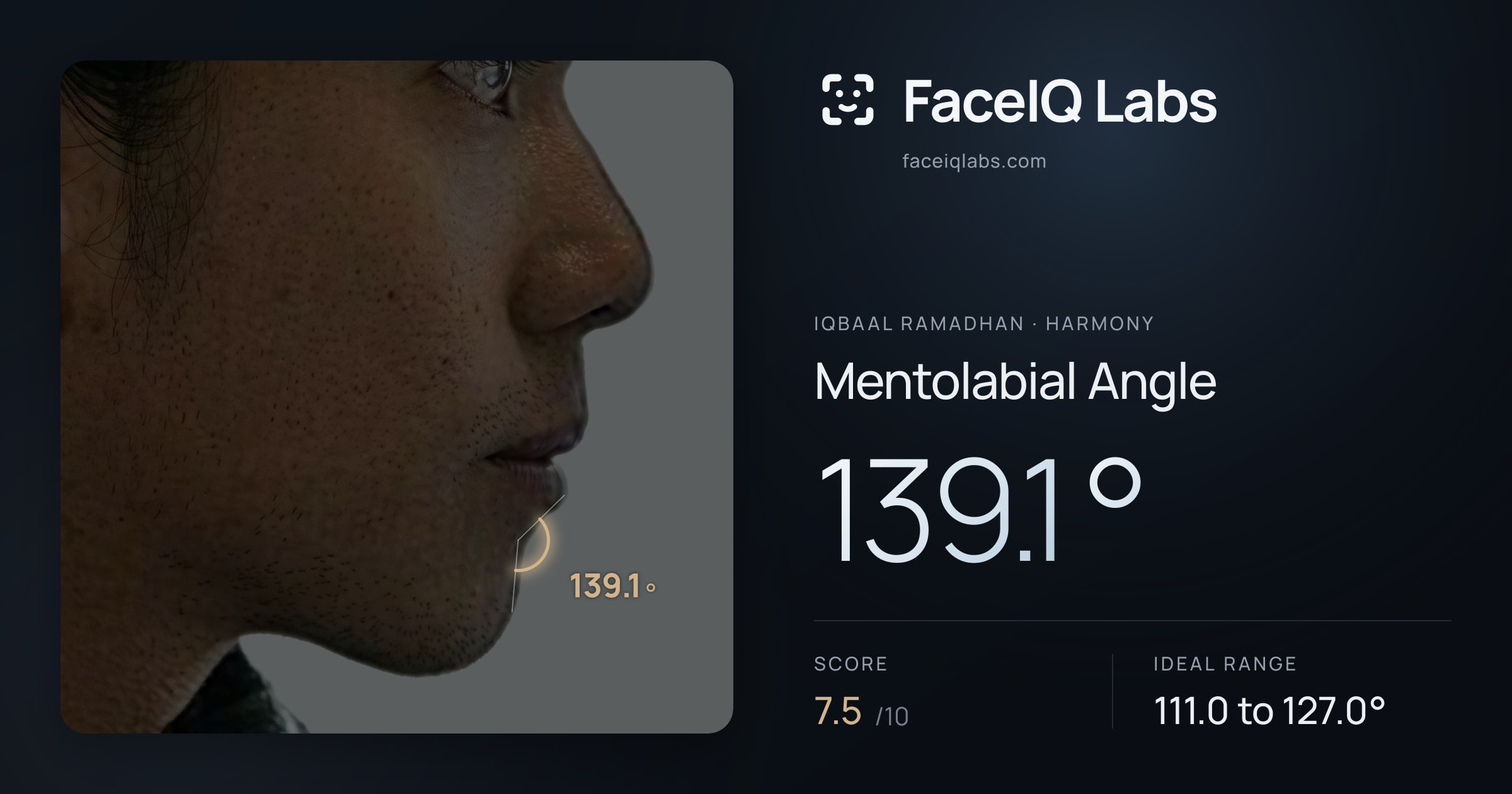 Iqbaal Ramadhan Mentolabial Angle: 139.1°, drawn on the photo