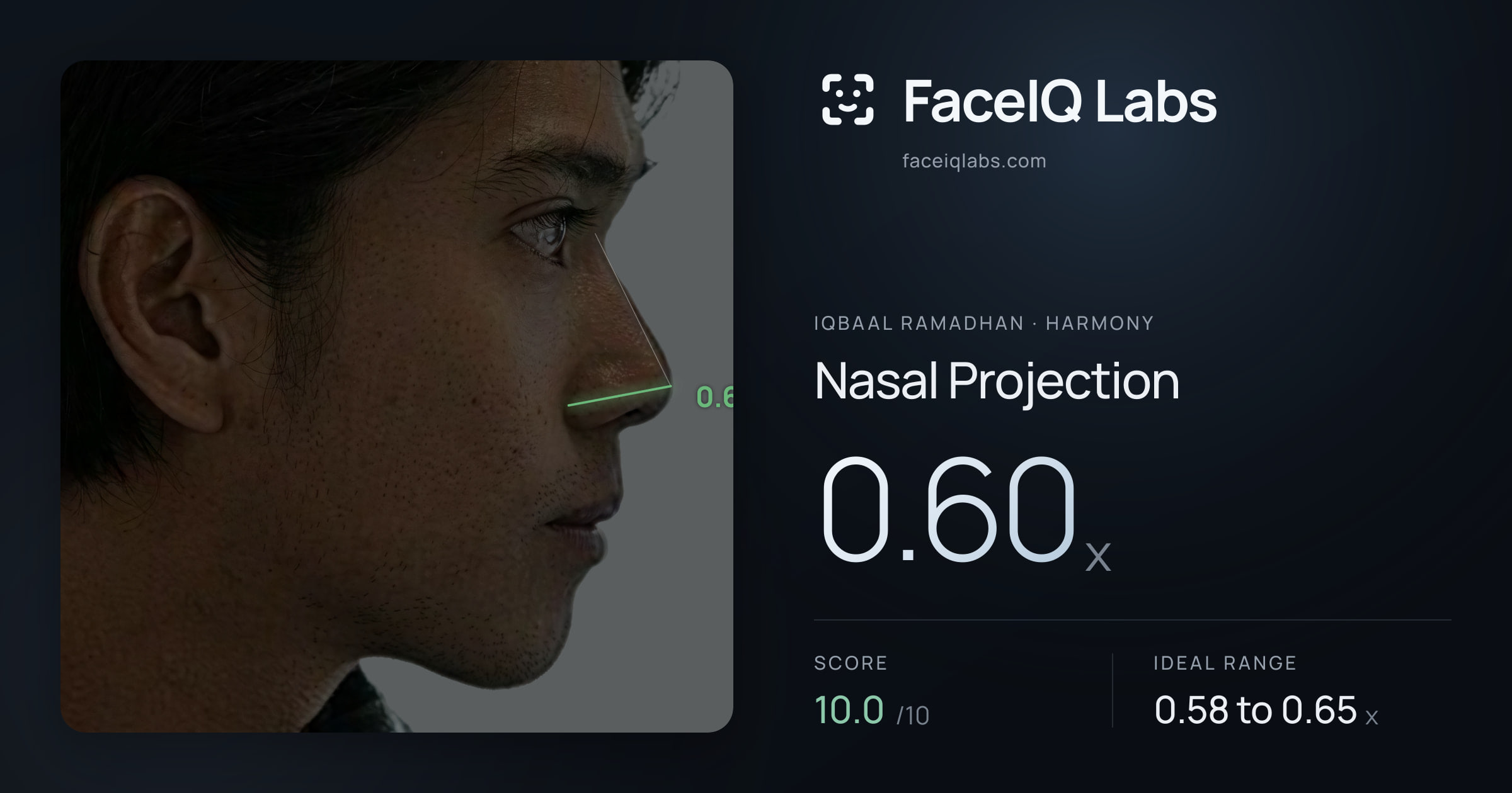 Iqbaal Ramadhan Nasal Projection: 0.60x, drawn on the photo