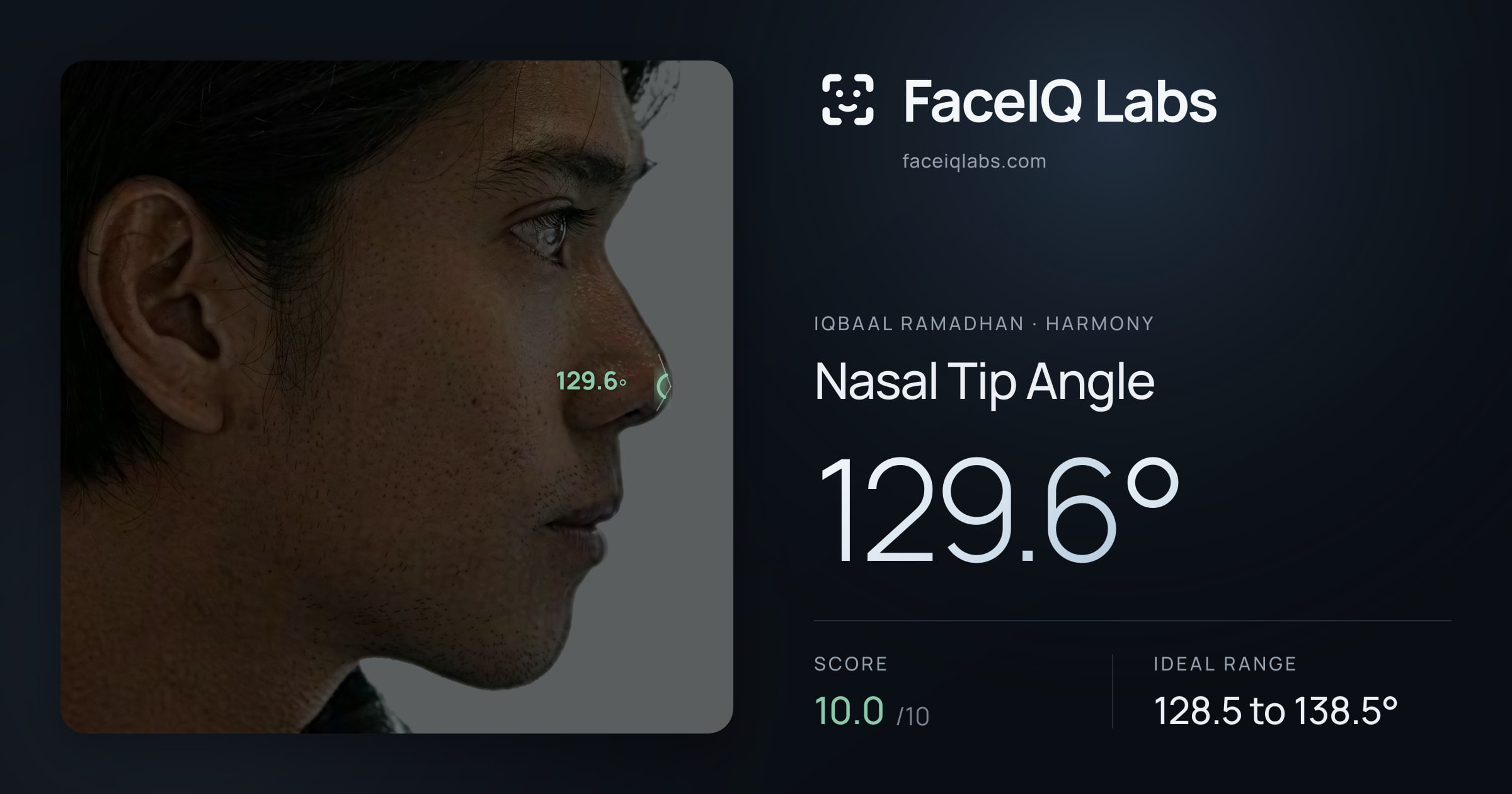 Iqbaal Ramadhan Nasal Tip Angle: 129.6°, drawn on the photo