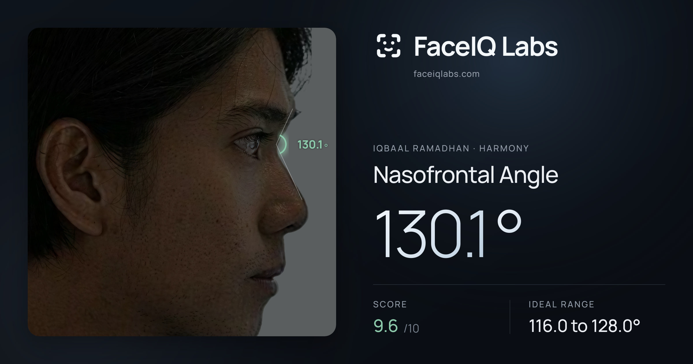Iqbaal Ramadhan Nasofrontal Angle: 130.1°, drawn on the photo