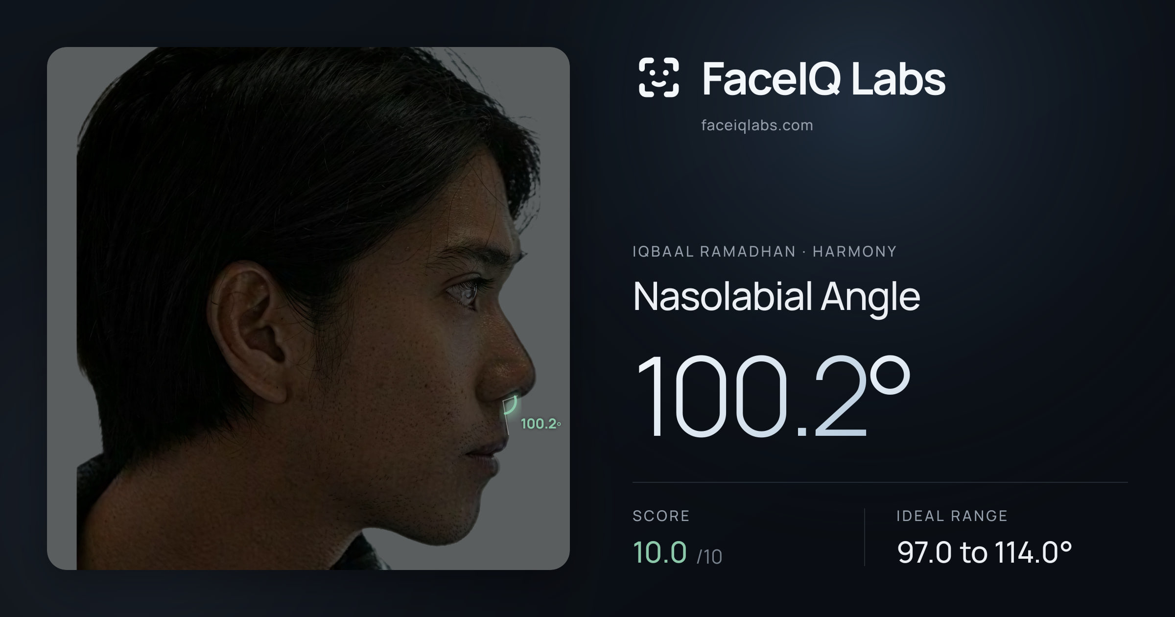 Iqbaal Ramadhan Nasolabial Angle: 100.2°, drawn on the photo