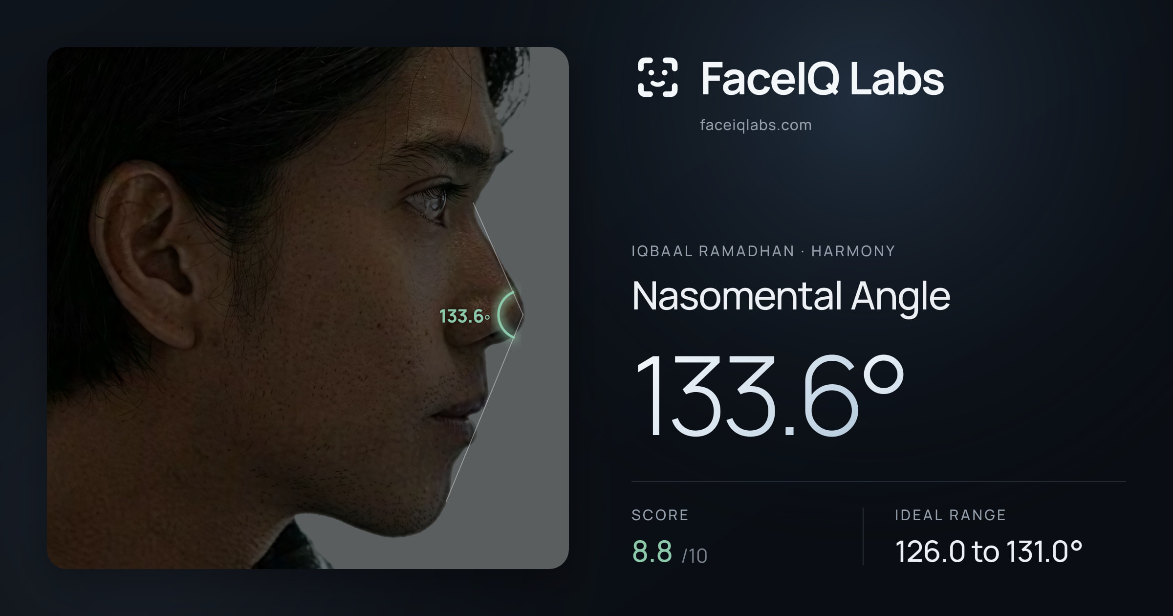 Iqbaal Ramadhan Nasomental Angle: 133.6°, drawn on the photo