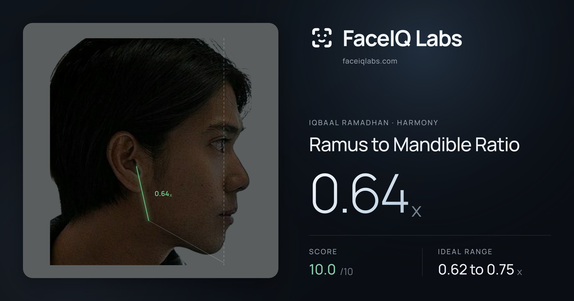 Iqbaal Ramadhan Ramus to Mandible Ratio: 0.64x, drawn on the photo